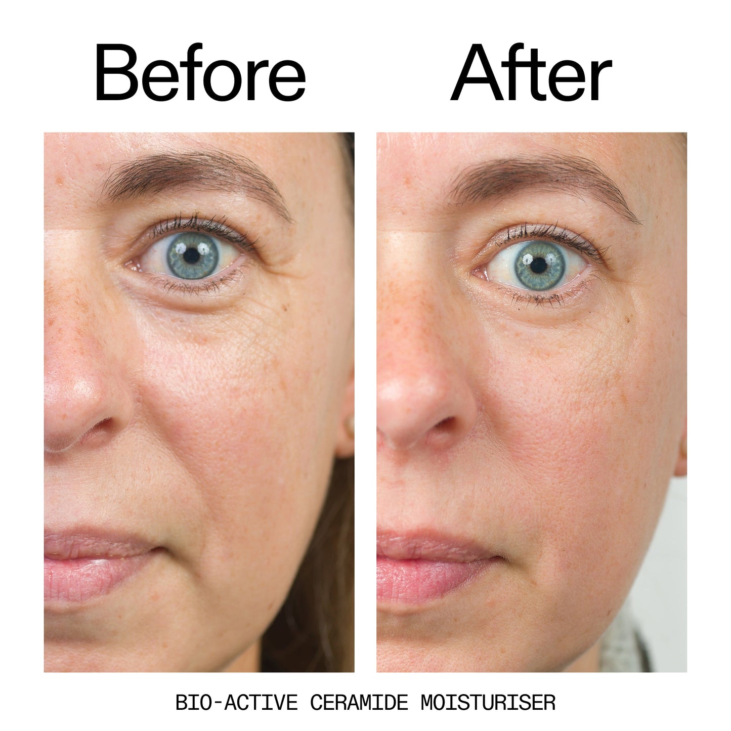 barrier-boosting-trio-z1 Bio-Active_Before_After_2000x2000_600947b4-e8c5-425a-9155-fc15bc83aa12.jpg