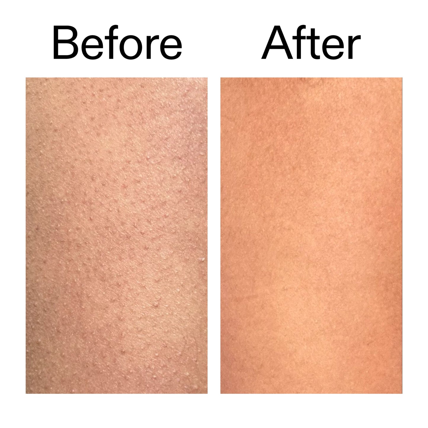 glycolic-acid-exfoliating-body-stick-h5 Glycolic_Body_Stick_B_A_2000x2000_6e6e6b4d-5bd7-43c0-aeed-4d66788e8995.jpg