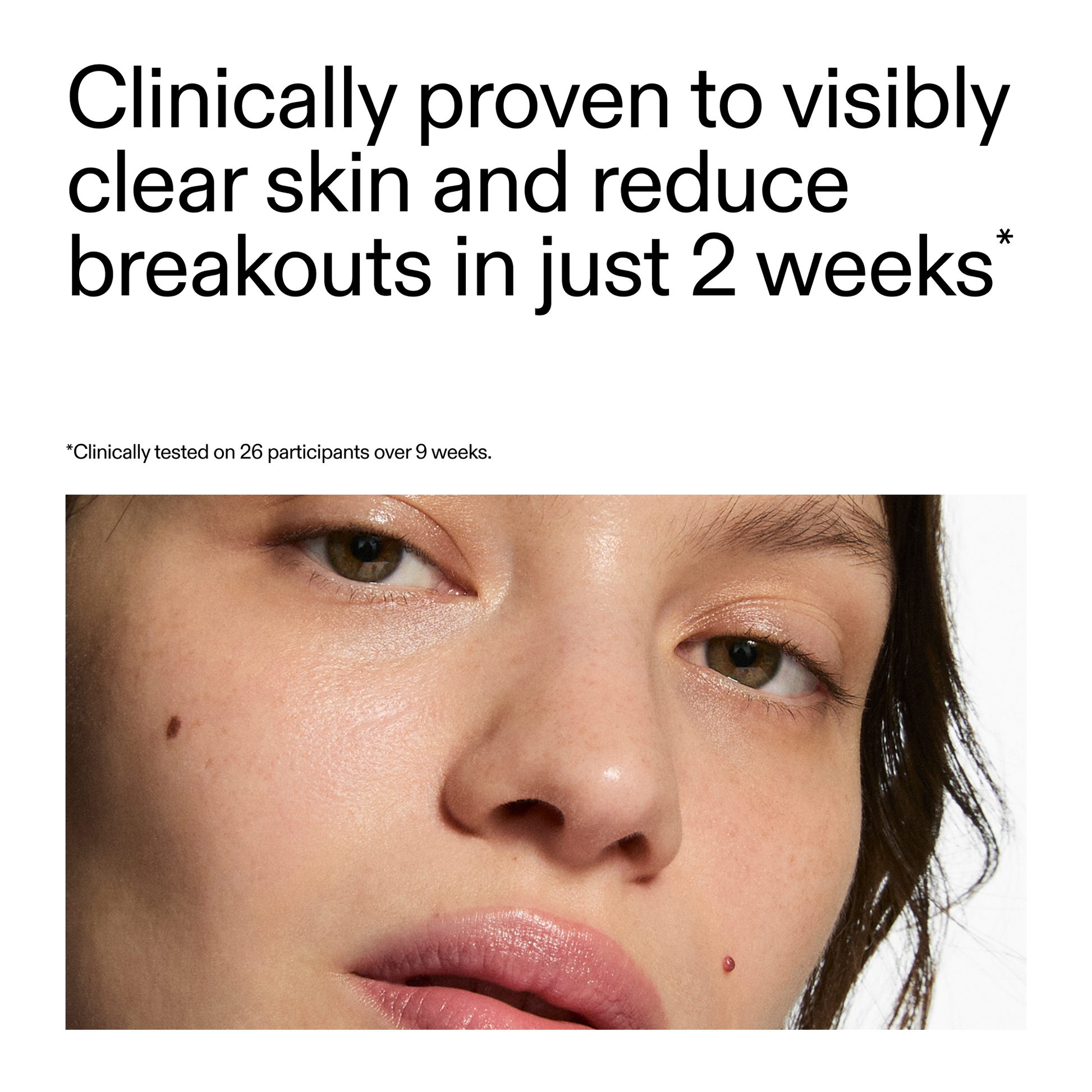 360-acne-clearing-duo-a2 360_Serum_Key_Claim.png