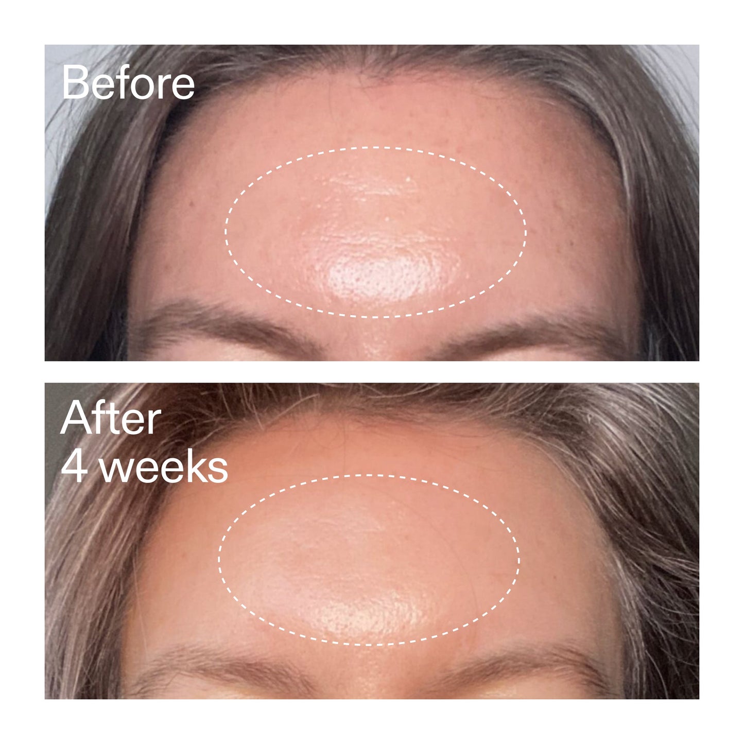 advanced-0-2-retinal-serum-duo-x1 AdvancedRetinal_BeforeAfter1_2000x2000_4e9c798a-f30e-45b8-a34a-7c4740f2f2cb.jpg