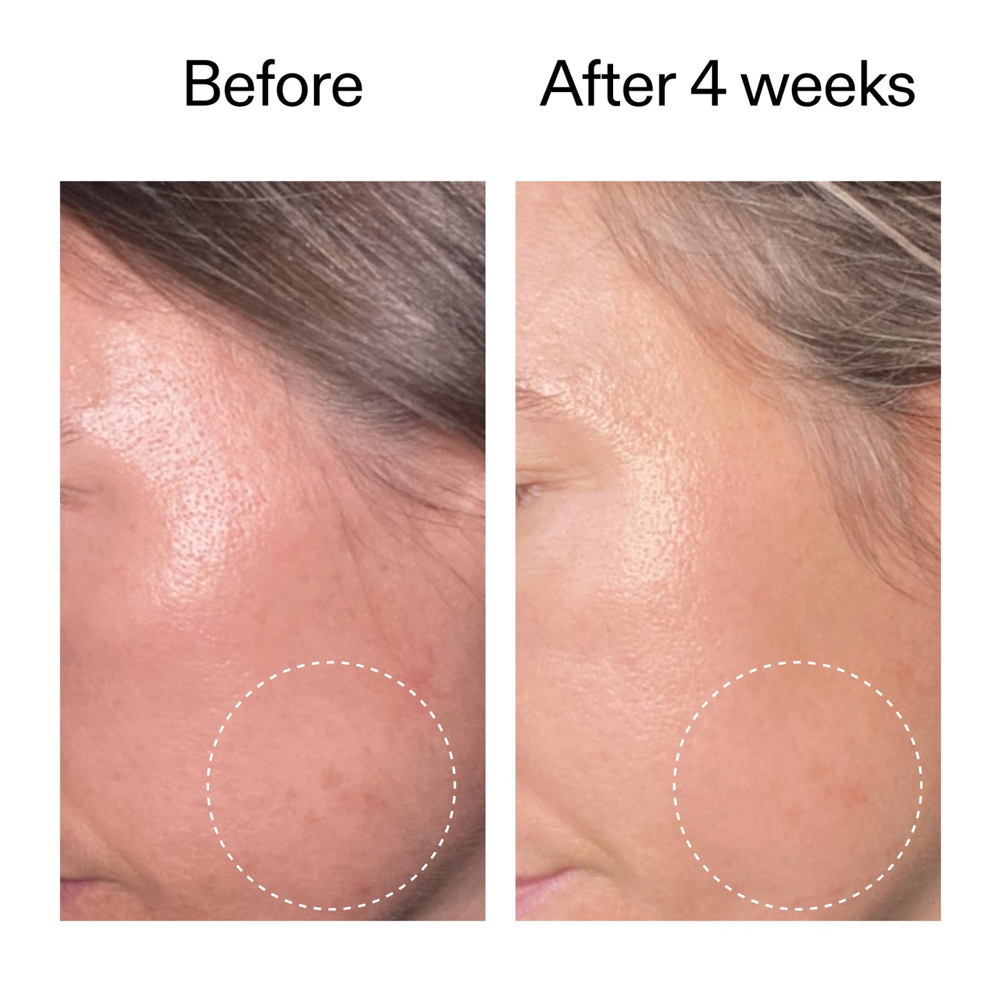 advanced-0-2-retinal-serum-t3 AdvancedRetinal_BeforeAfter2__2000x2000_62fb16bb-77ae-4d63-8500-88dbf847f4b9.jpg