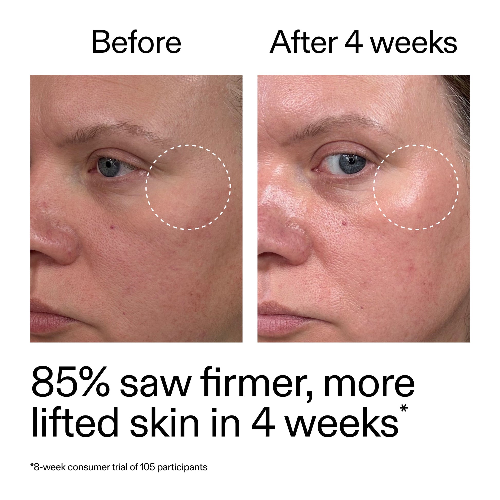 advanced-0-2-retinal-serum-duo-x1 AdvancedRetinal_BeforeAfter_Claim1_2000x2000_3a315aa8-f408-4b33-bbeb-0d9209f98404.jpg