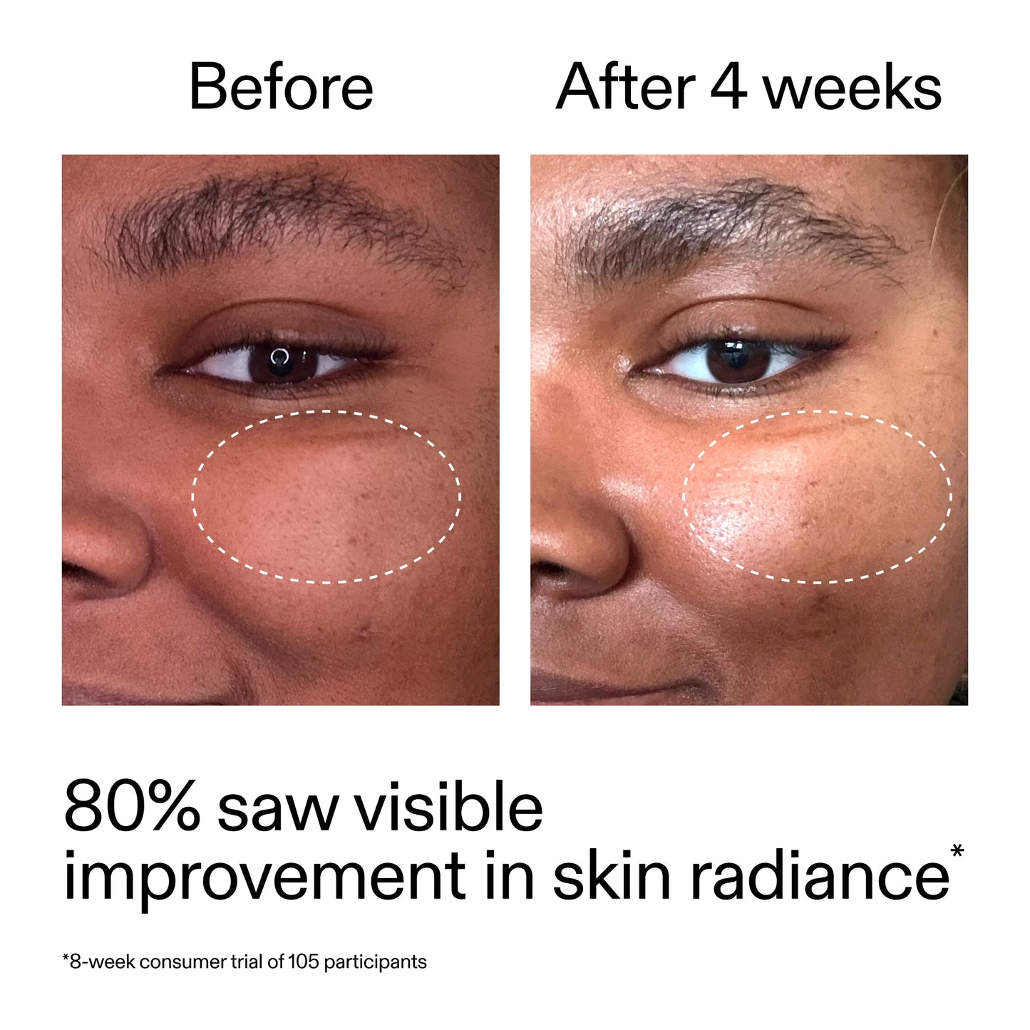 advanced-0-2-retinal-serum-duo-x1 AdvancedRetinal_BeforeAfter_Claim2_2000x2000_681b621d-8d44-4d44-9a40-89244f9b2e53.jpg
