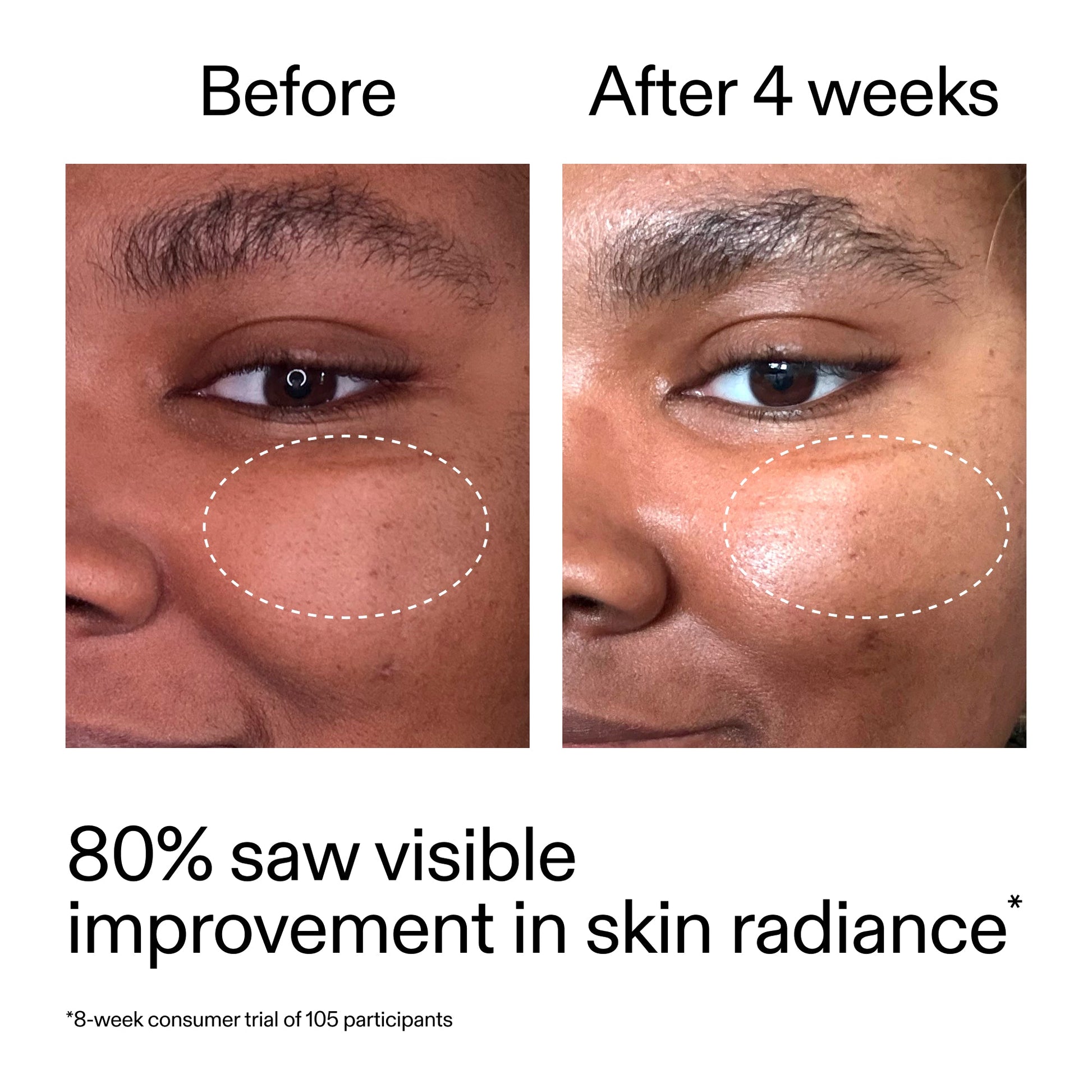 advanced-0-2-retinal-serum-duo-x1 AdvancedRetinal_BeforeAfter_Claim2_2000x2000_681b621d-8d44-4d44-9a40-89244f9b2e53.jpg