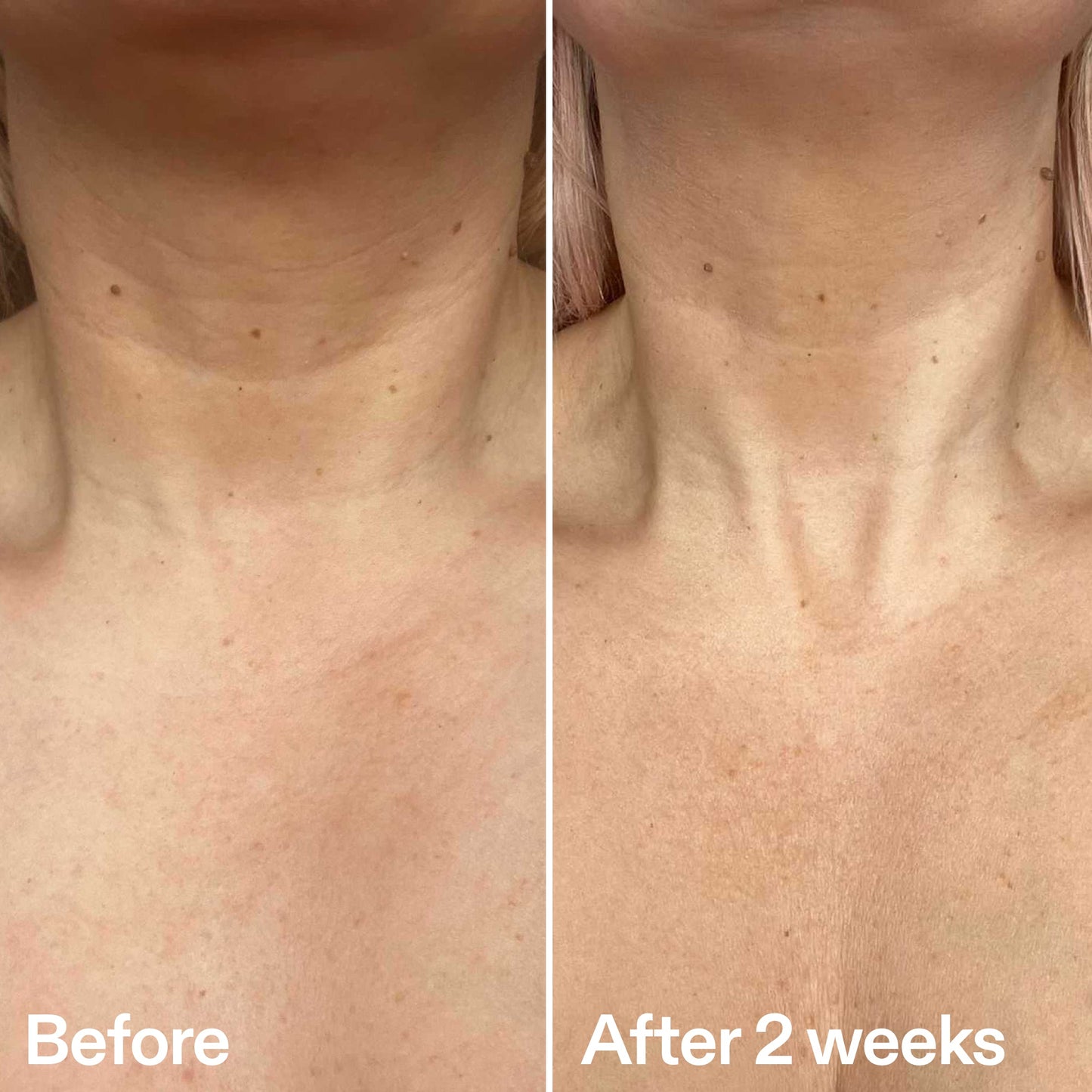 bio-active-neck-lift-stick-d6 B_A_2.jpg