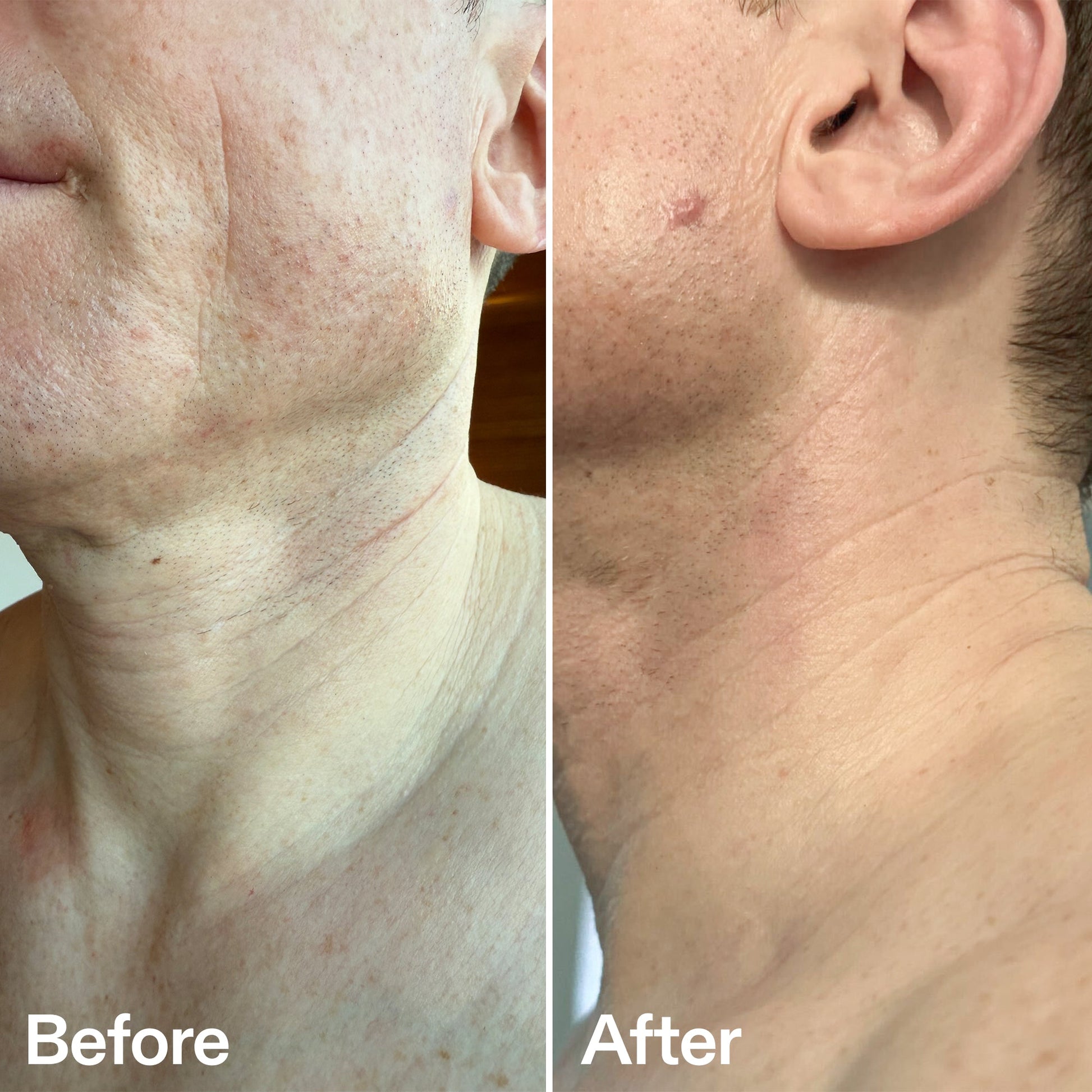 bio-active-neck-lift-stick-d6 B_A_afa2743e-b8e2-4504-92f4-e281cb6cf759.jpg