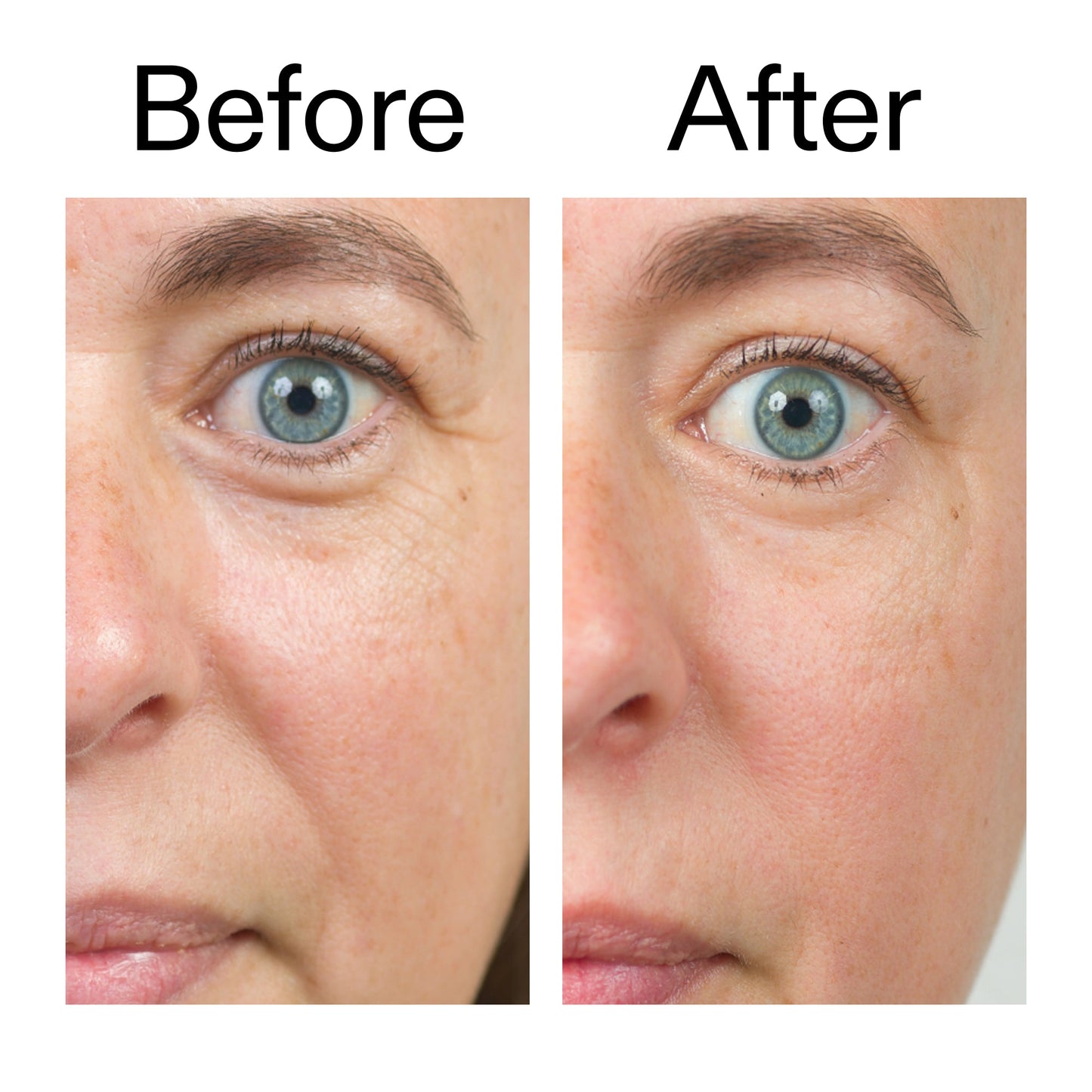 bio-active-ceramide-moisturizer-duo-u5 Bio-Active_Before_After_2000x2000_566e5a9e-135e-417a-8242-b44e5fa35463.jpg
