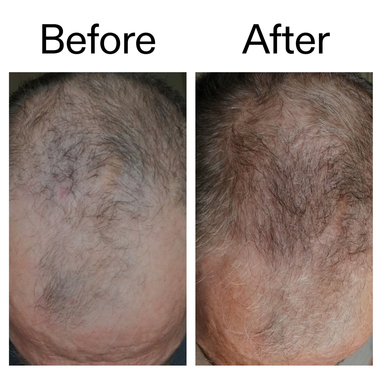 3-month-hair-growth-trio-r0 Caffeine_Scalp_Treatment_B_A_Ppage_2000_x_2000.jpg