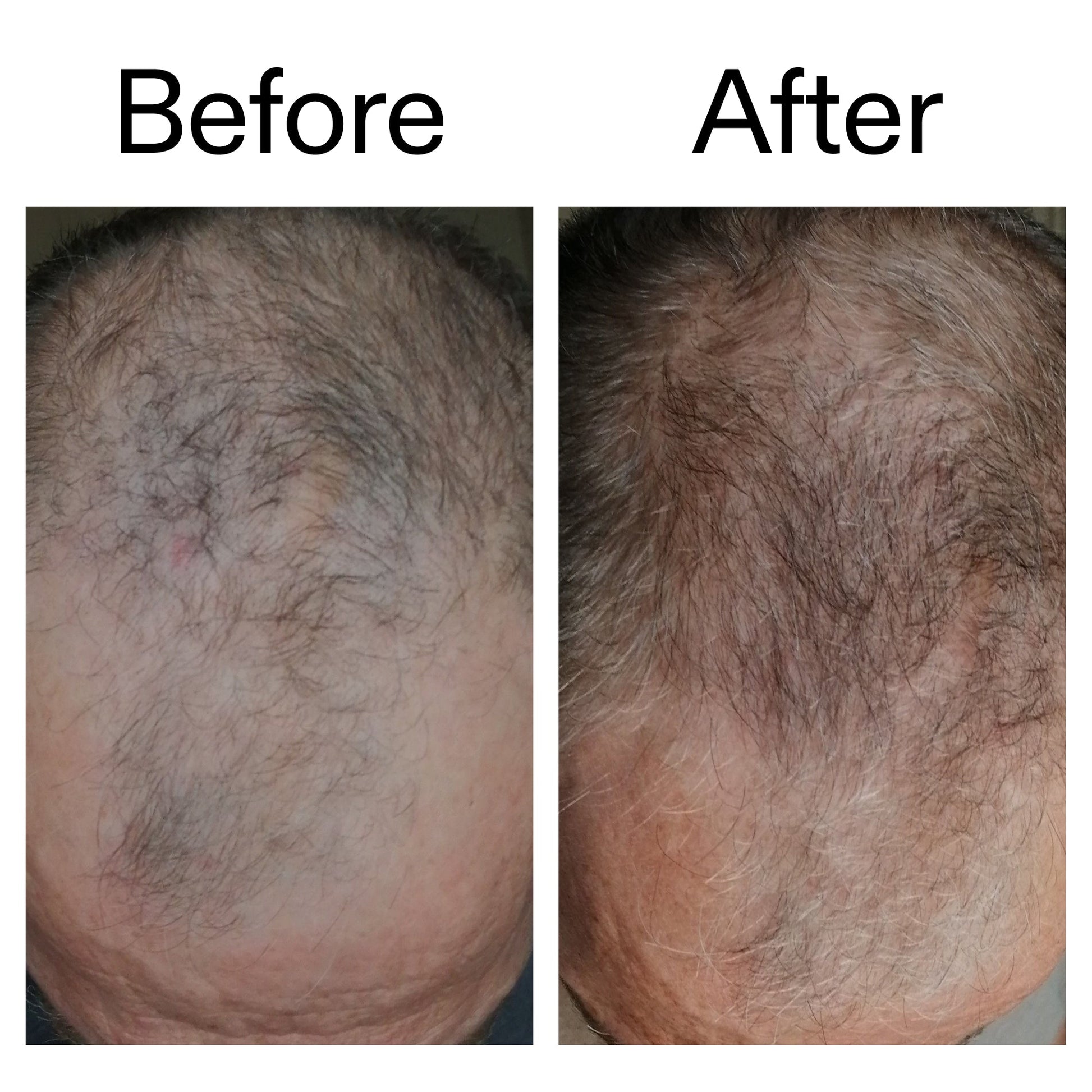 caffeine-stimulating-scalp-treatment-m1 Caffeine_Scalp_Treatment_B_A_Ppage_2000_x_2000.jpg