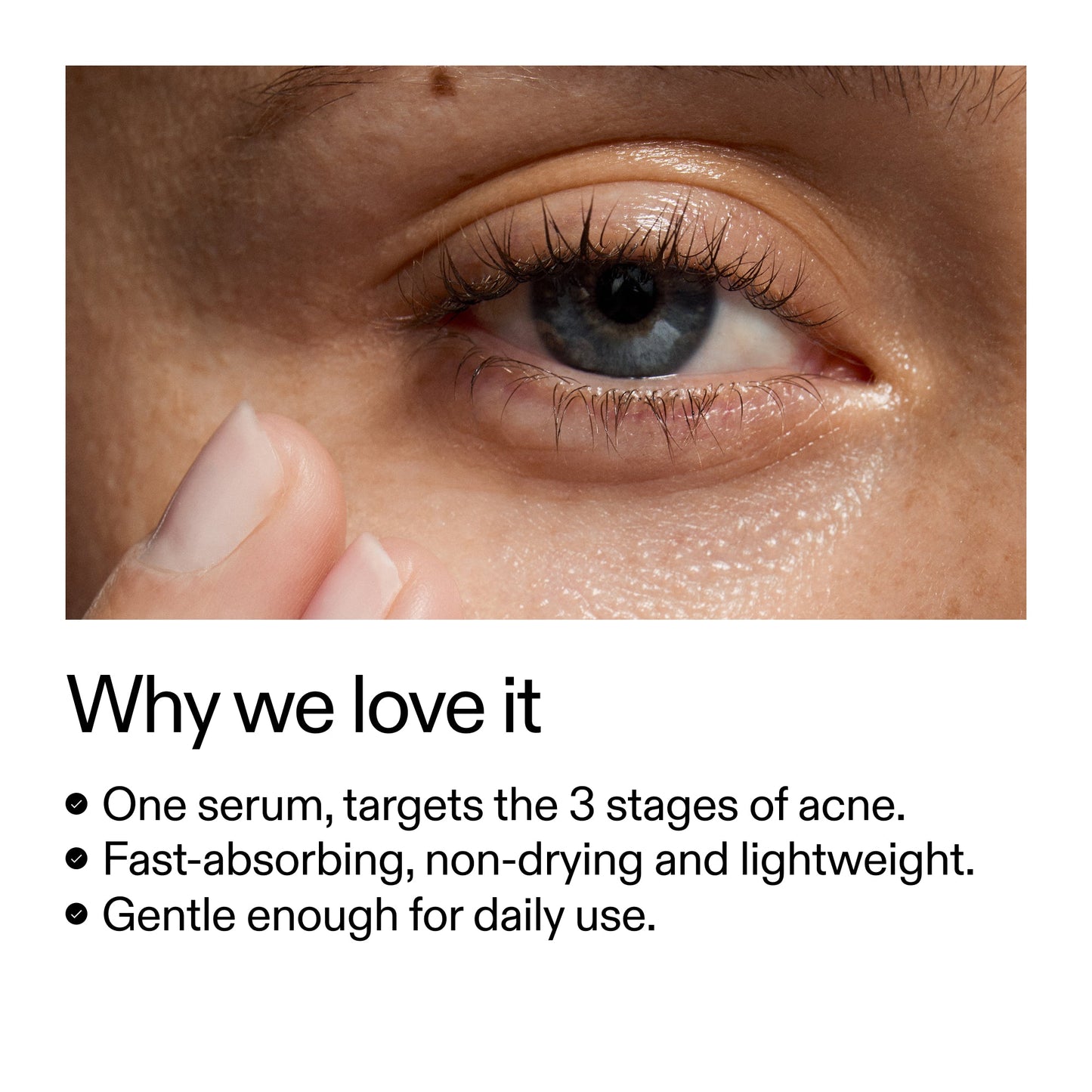 360-acne-clearing-duo-a2 Dioic_Whyweloveit_2000x2000_175aafd3-0cbe-403a-b317-a8362881bfe2.jpg