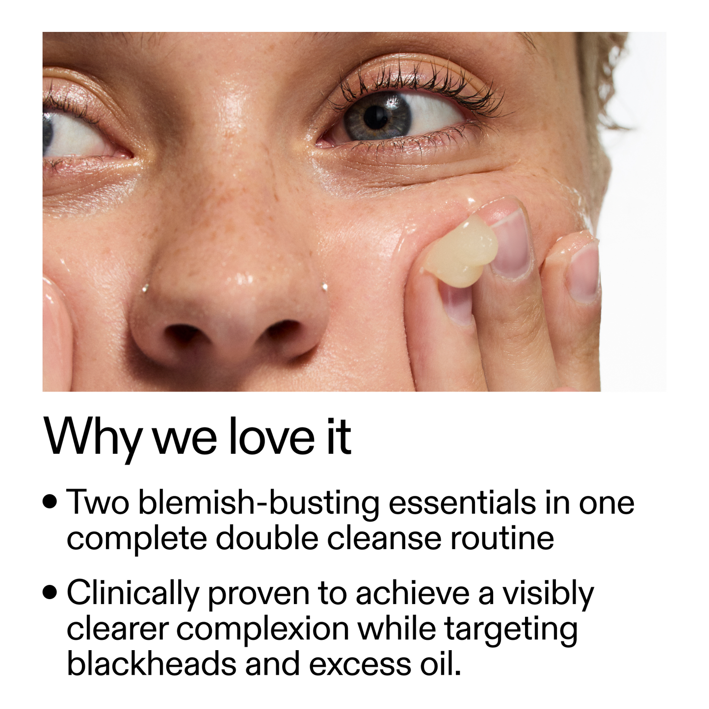 acne-double-cleanse-duo-w7 Double_Cleanse_Duo_for_Breakouts_Why_We_2000x2000_f242cb12-bb5c-487c-b203-071ccb406ec5.png