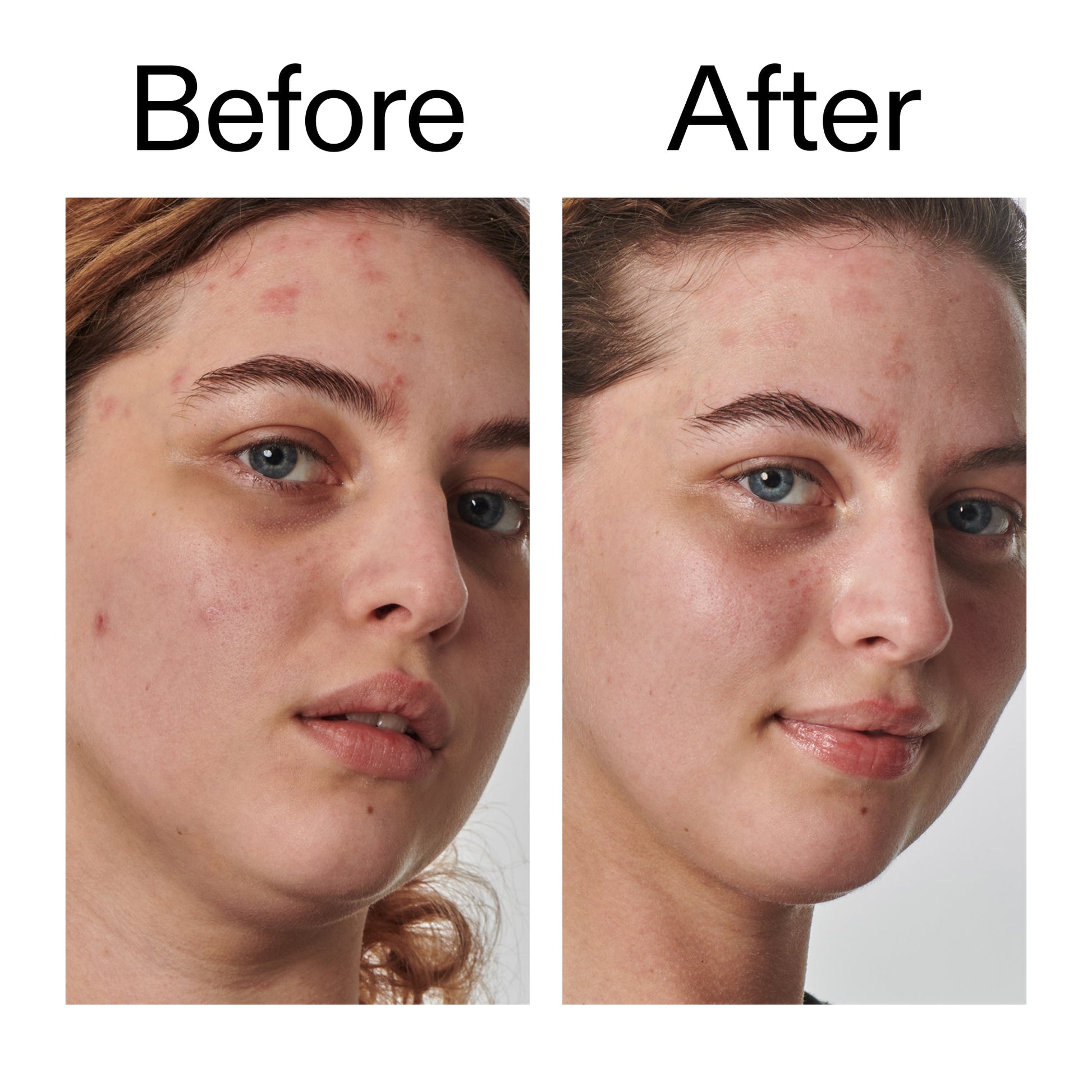 10-urea-moisturizer-j9 Dry_and_Rough_Skin_Solution_Before_After_2000x2000_efa6e639-5c39-49bd-a5dd-f0220293120a.jpg