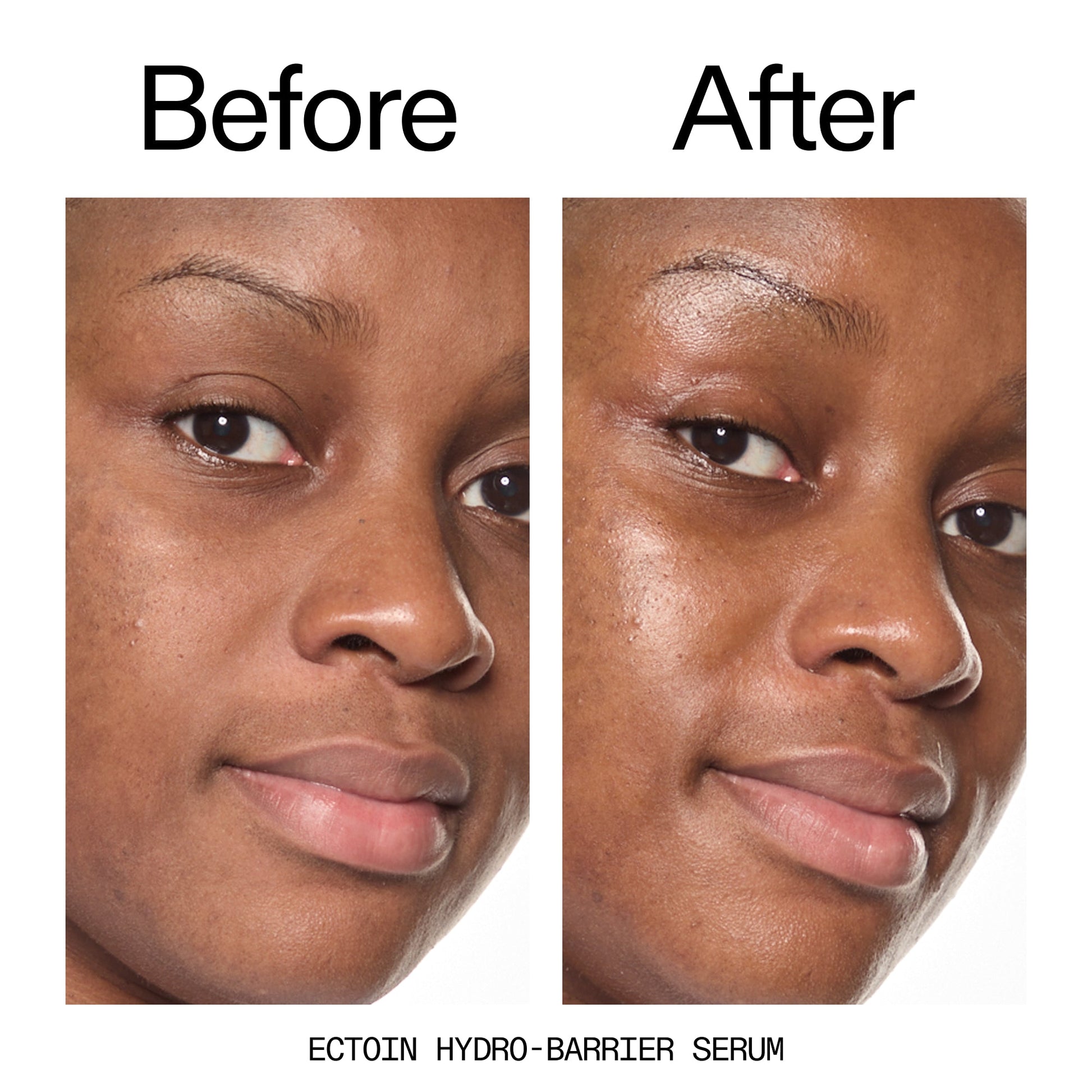 barrier-boosting-trio-z1 Ectoin_Before_After_2000x2000_ce35bc41-4da0-4b6f-adc7-29f8641f6c6c.jpg