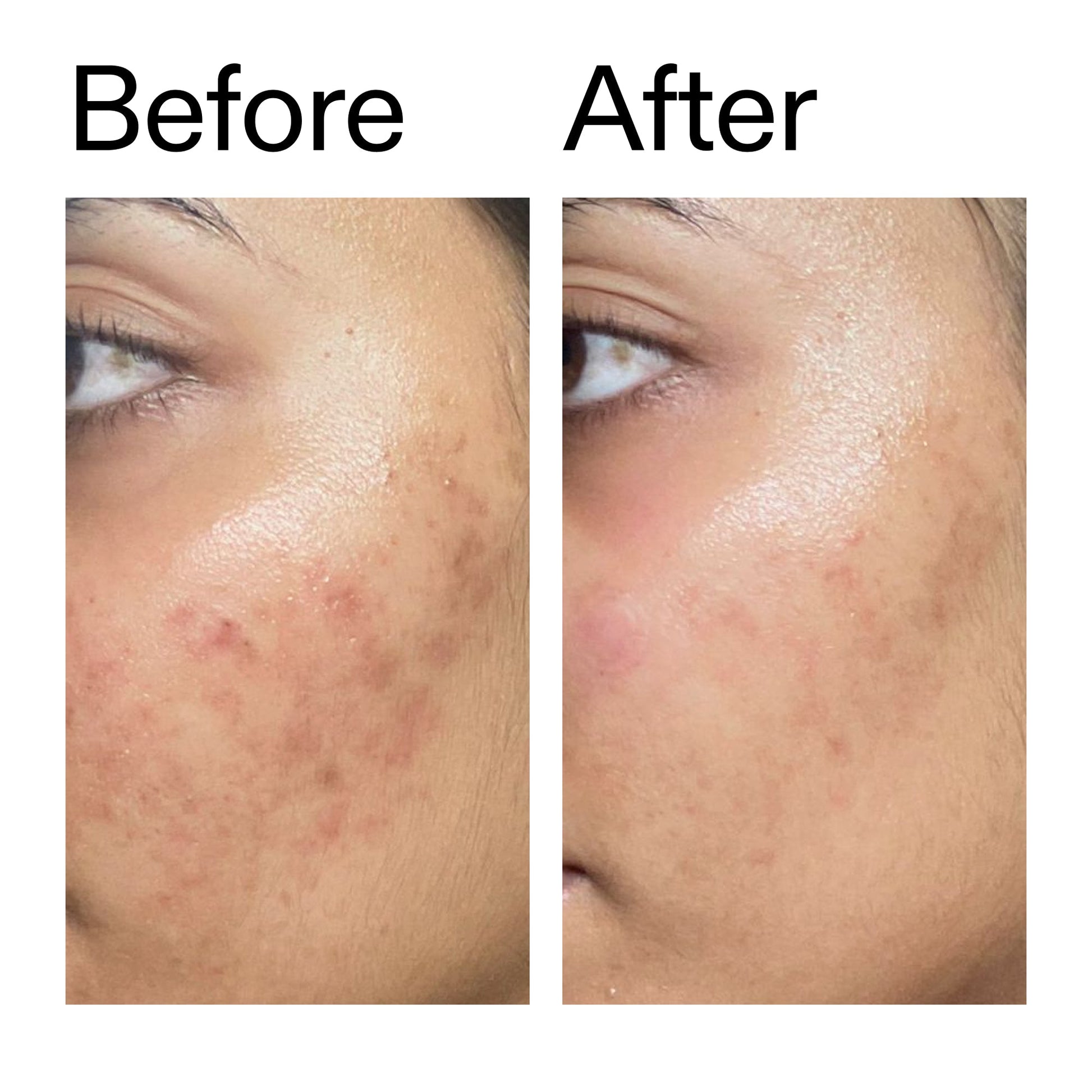 ectoin-hydro-barrier-serum-s5 Ectoin_Hydro-barrier_Serum__Before_After_2000x2000_34261920-d004-48d0-9c7b-8e1c15971bfd.jpg