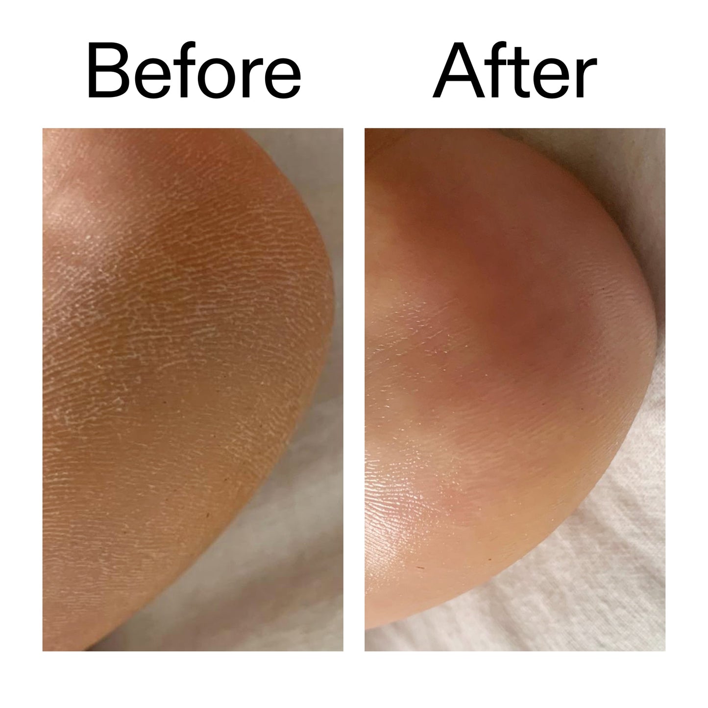 glycolic-acid-exfoliating-body-stick-h5 Glycolic_Acid_Exfoliating_Body_Stick_Before_After_V1_2000x2000_a3043625-9400-429a-a7fb-d6dbd220f722.jpg
