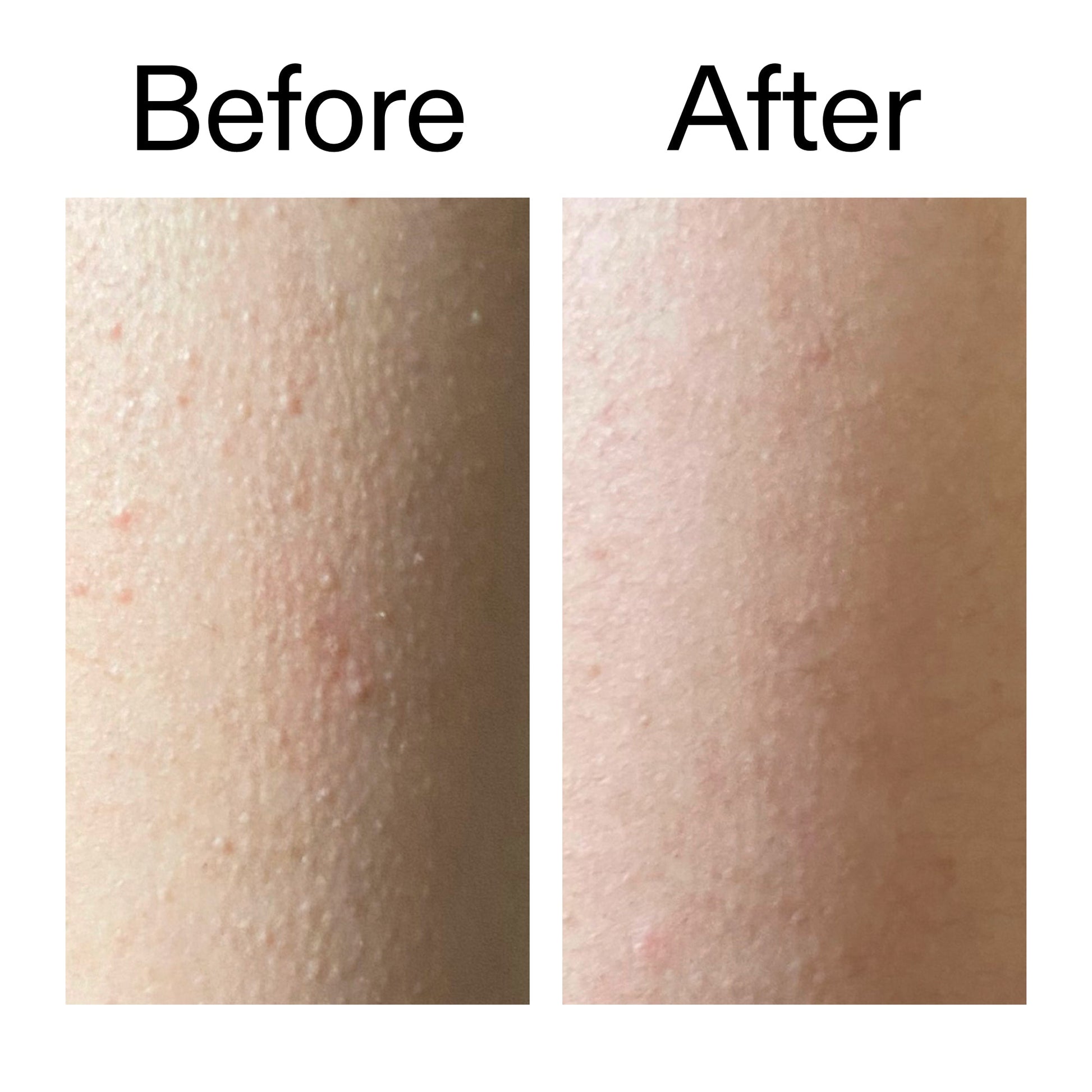 glycolic-acid-exfoliating-body-stick-duo-e1 Glycolic_Acid_Exfoliating_Body_Stick_Before_After_V2_2000x2000_2e4ba052-94f6-4d56-82df-7bdb5b2df7ae.jpg