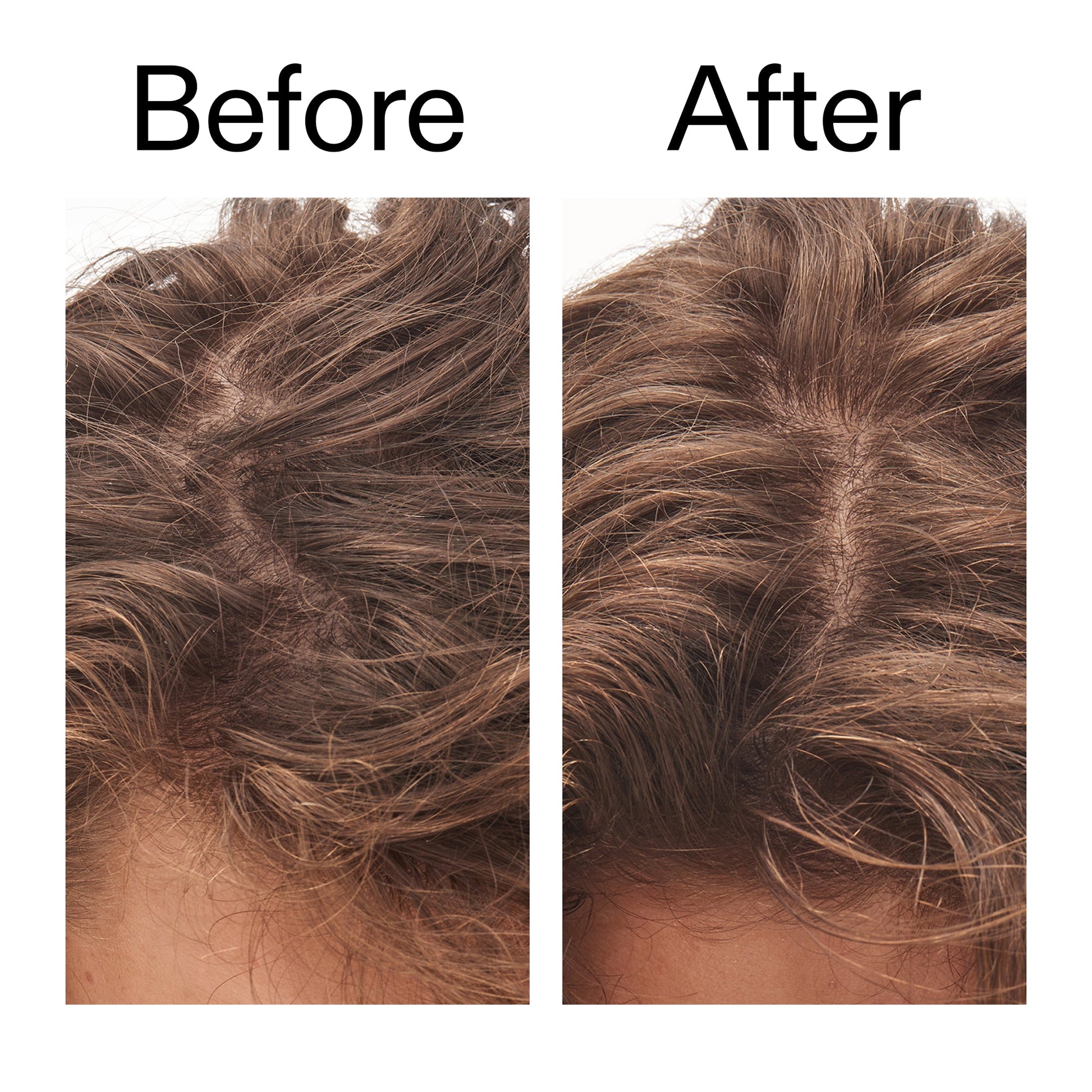 glycolic-acid-exfoliating-scalp-scrub-n0 Glycolic_Acid_Exfoliating_Scalp_Scrub_Before_After_2000x2000_b8561c87-05a1-4caa-80f7-1b6b33d750f7.jpg