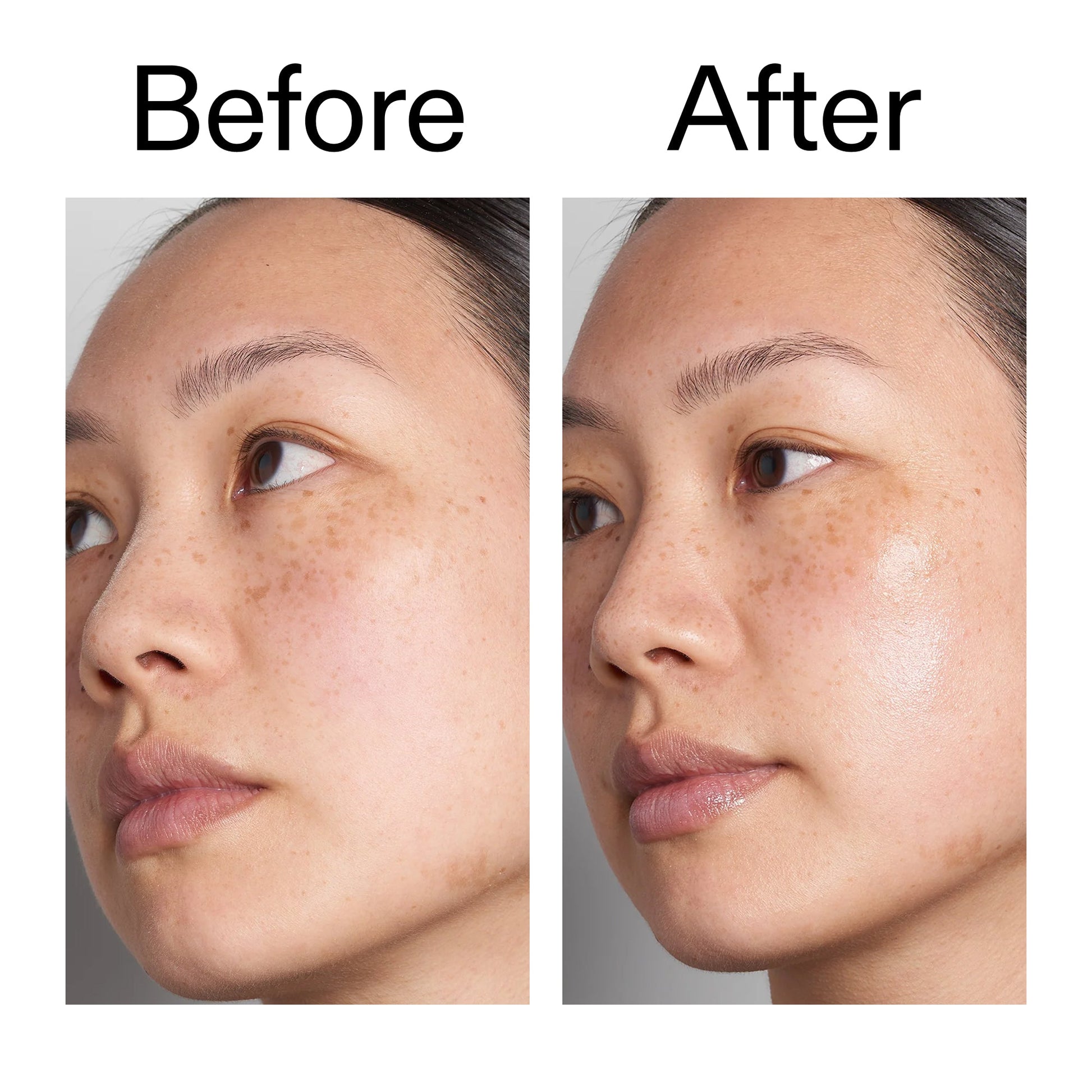 hyaluronic-acid-serum-30ml-q1 Hyaluronic_Acid_Before_After_2000x2000_d7983956-8aa2-4ea3-8255-c63e8d4f892e.jpg