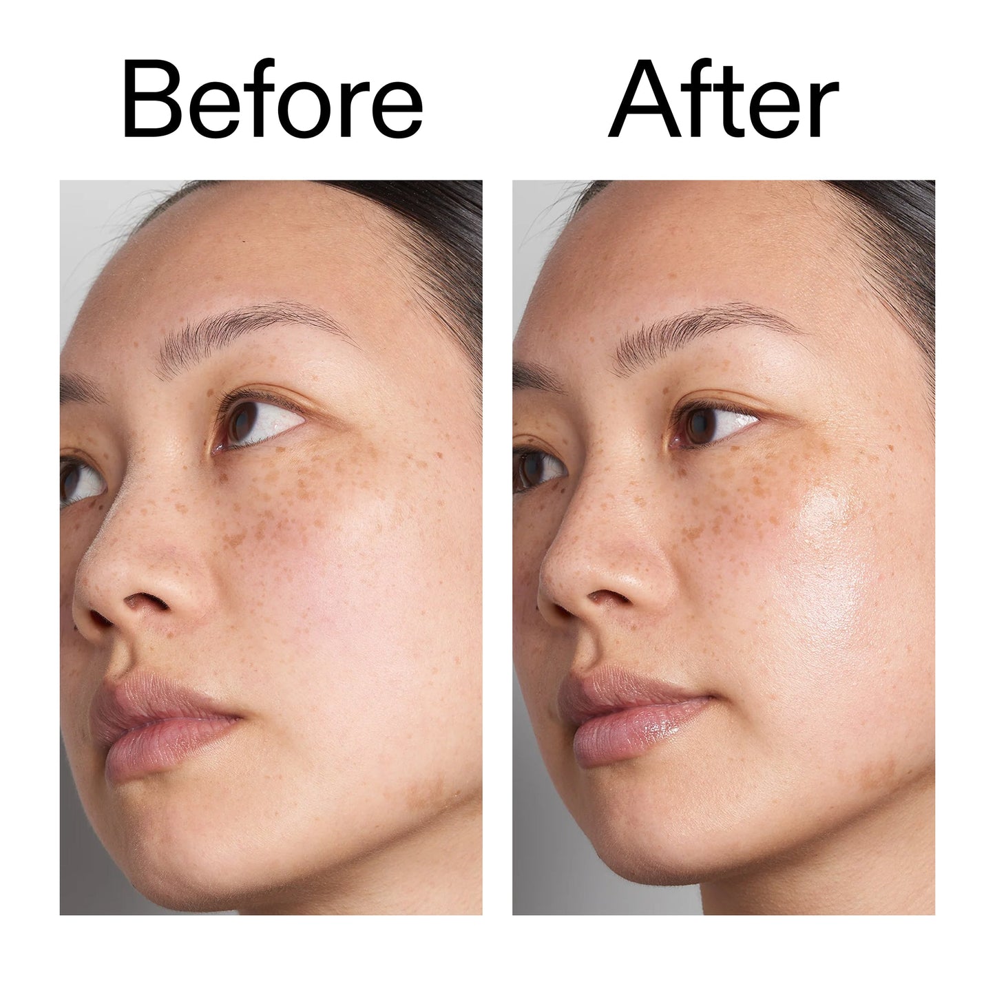 hyaluronic-acid-serum-60ml-x2 Hyaluronic_Acid_Before_After_2000x2000_d7983956-8aa2-4ea3-8255-c63e8d4f892e.jpg