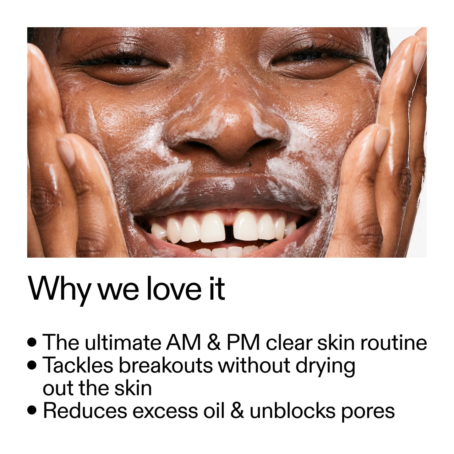 intro-routine-for-acne-o3 Intro_Routine_for_Acne_Why_we_love_it_2000x2000_42499e10-4629-4a0e-a627-7e215f4da6bc.jpg
