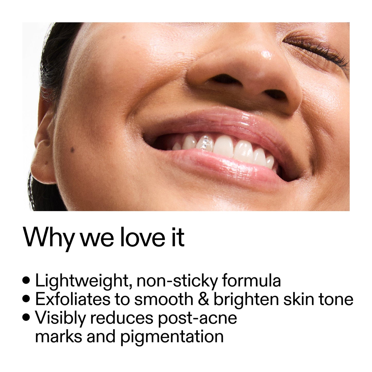 mandelic-acid-treatment-t8 Mandelic_Acid_Treatment_Why_we_love_it_2000x2000_6dfe29a9-2a79-464f-a5e8-e5ac37d93388.jpg