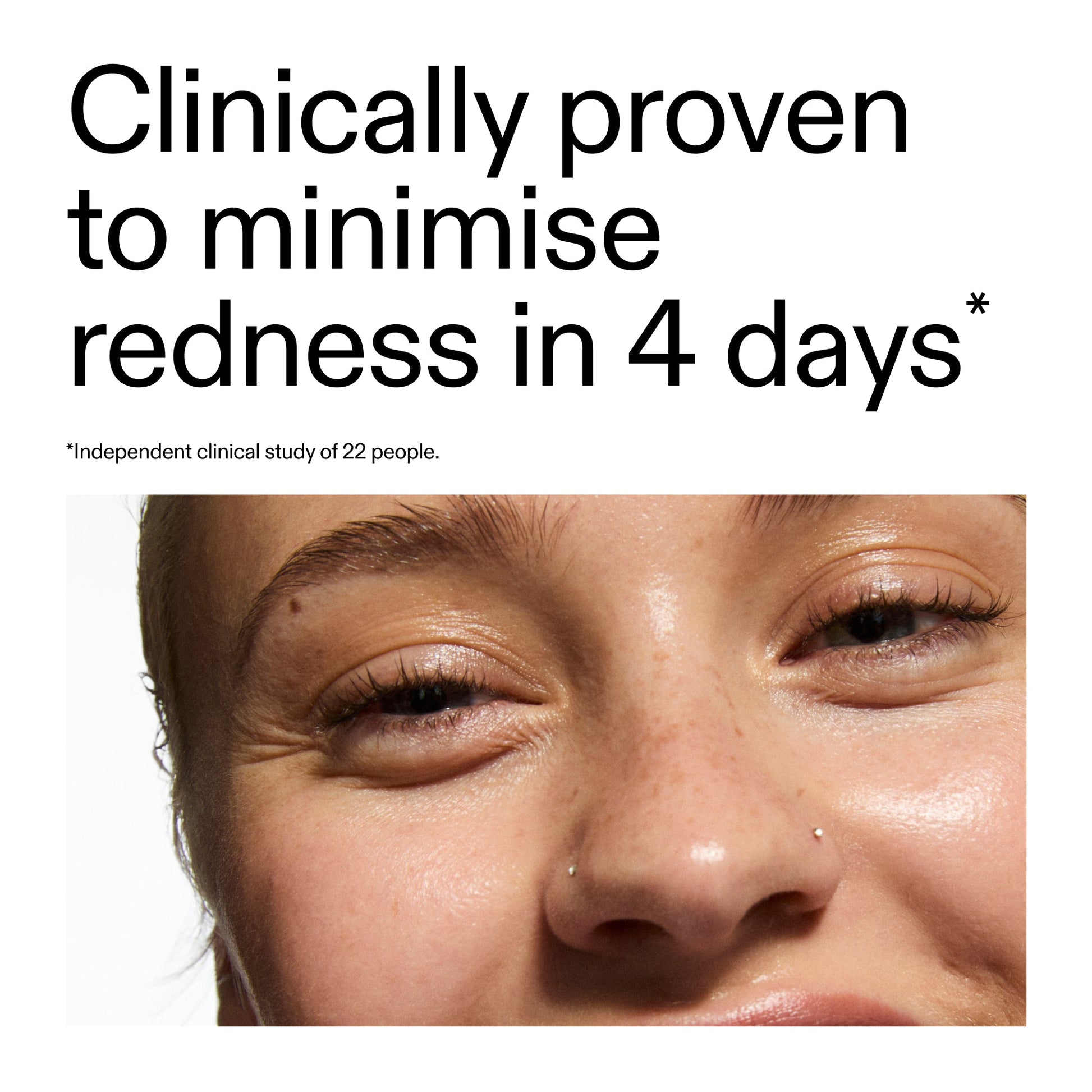 10-azelaic-acid-serum-for-redness-relief-l3 Oat_Cleansing_Balm_Claim_2000x2000_52a841dc-353c-4f2c-8646-3aadb604507d.jpg
