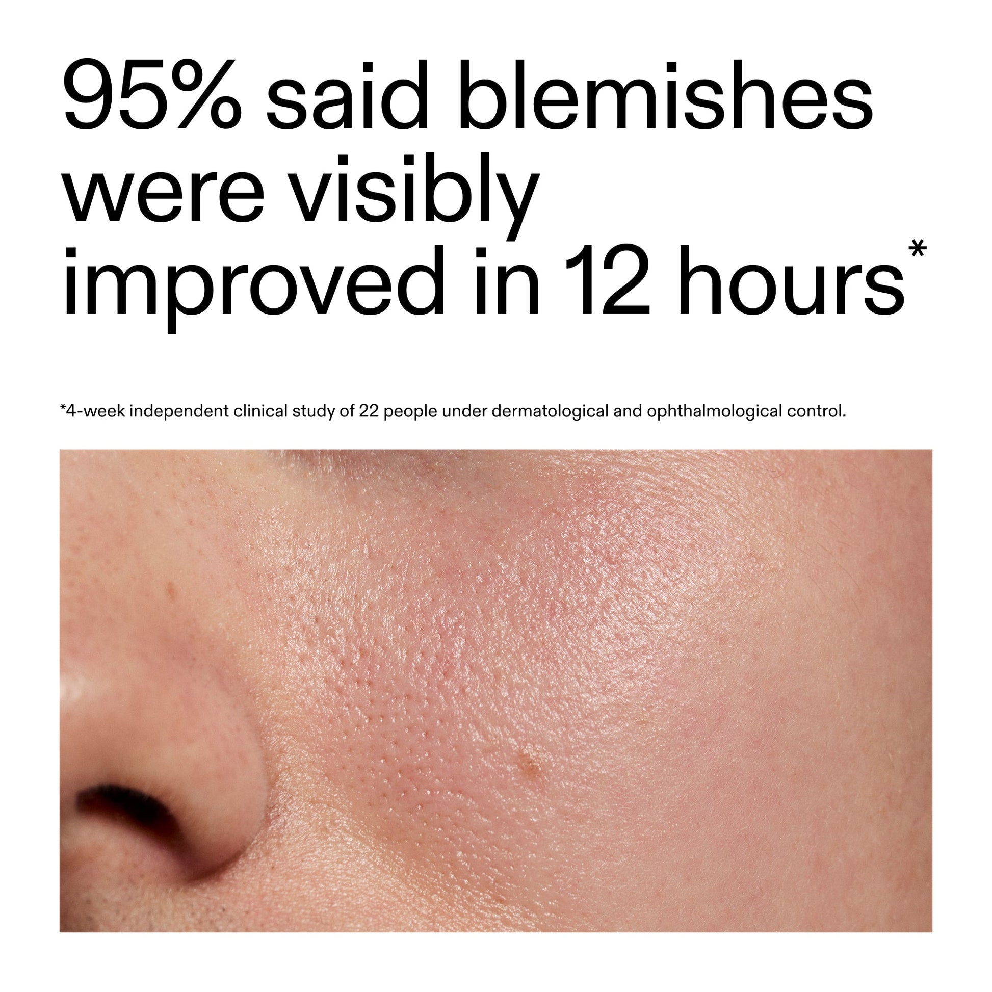 succinic-acid-acne-treatment-c4 Oat_Cleansing_Balm_Claim_2000x2000_ac6ce553-25db-41b2-a981-faae1ac4b8c0.jpg