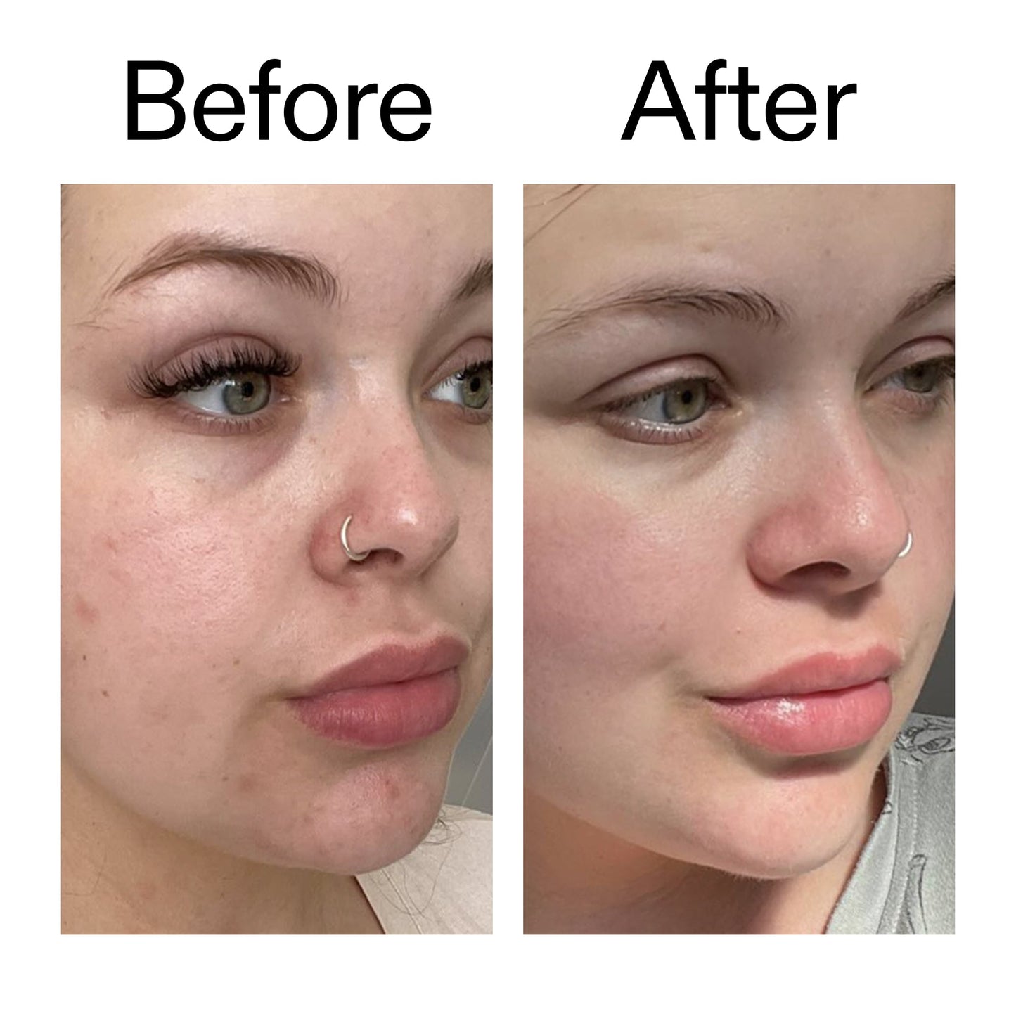 omega-water-cream-50ml-a5 Omega50_Before_After_2000x2000_46483ed8-3f9d-487f-9a0c-9df79830bd65.jpg