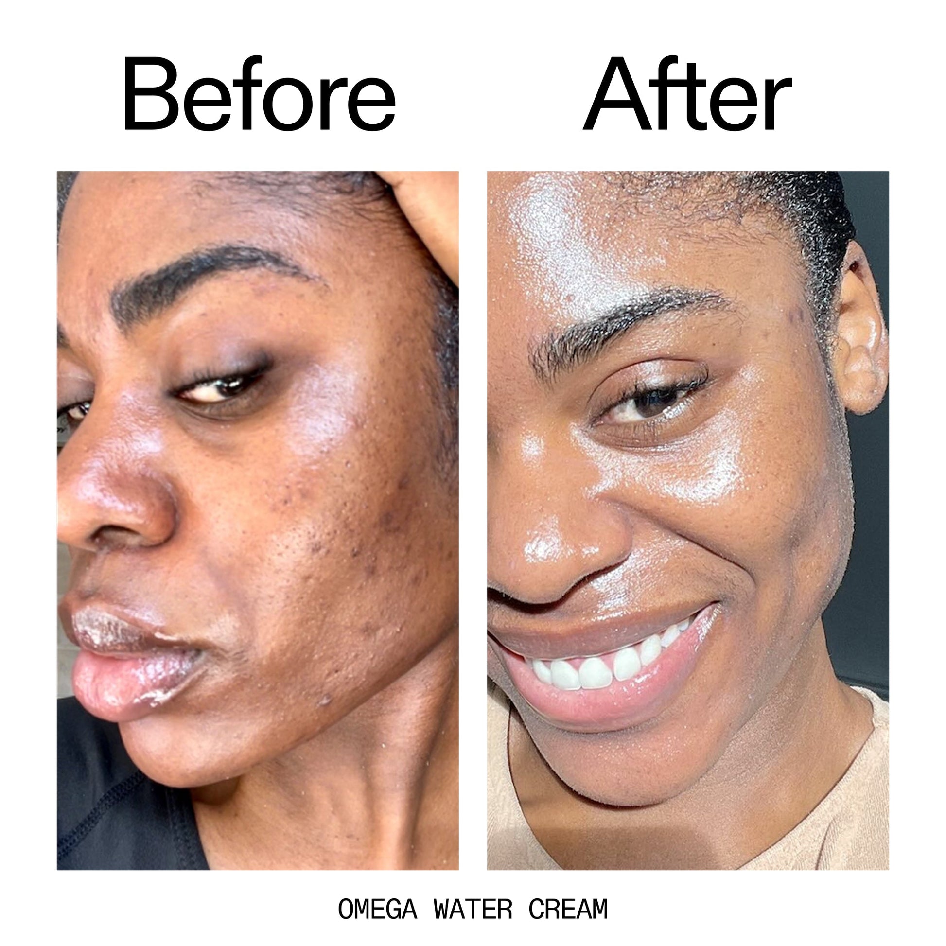 hydrating-cleanser-and-moisturizer-duo-k1 Omega_Water_Cream_Before_After_2000x2000_8e88278b-8c8d-48dc-ac77-4e98ebbd1b77.jpg