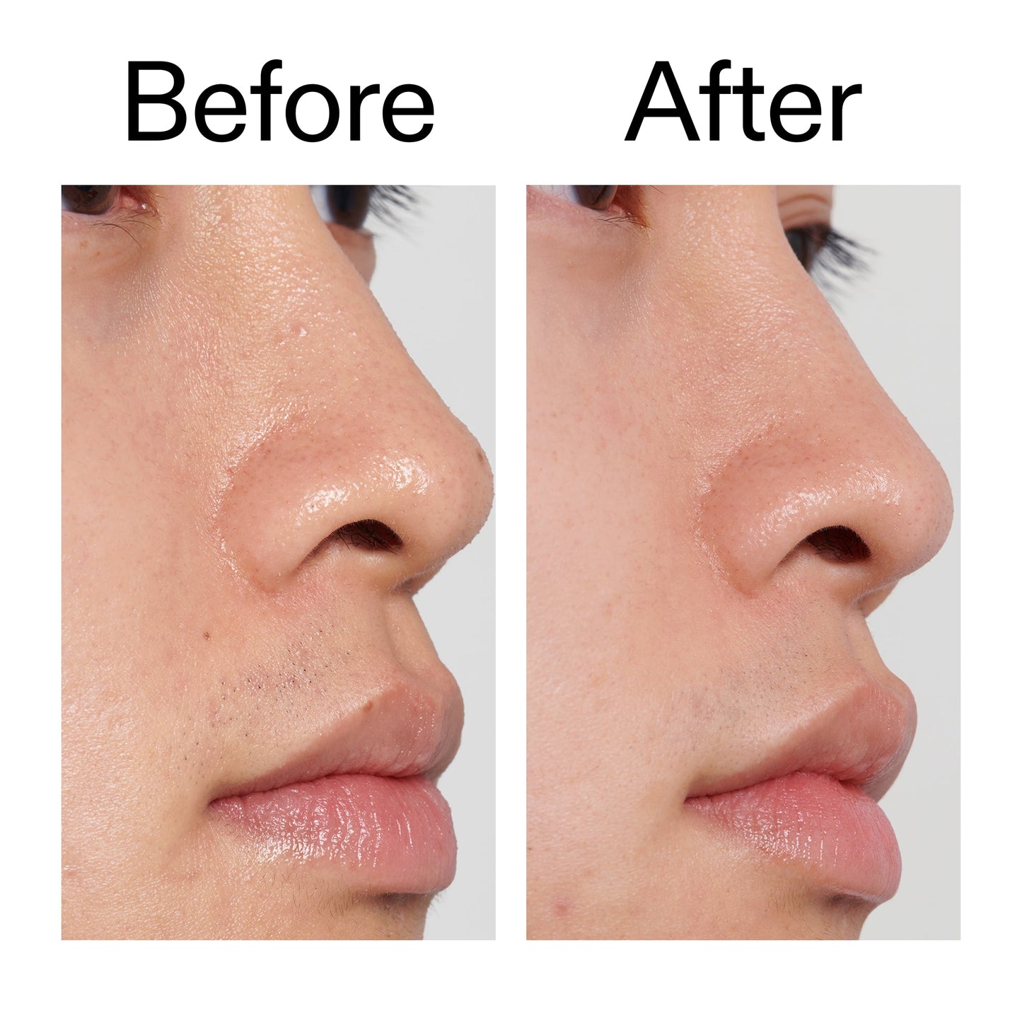 pha-toner-z7 PHA_Toner_Before_After_2000x2000_e3c10172-0150-4342-8b95-57417eaff50d.jpg