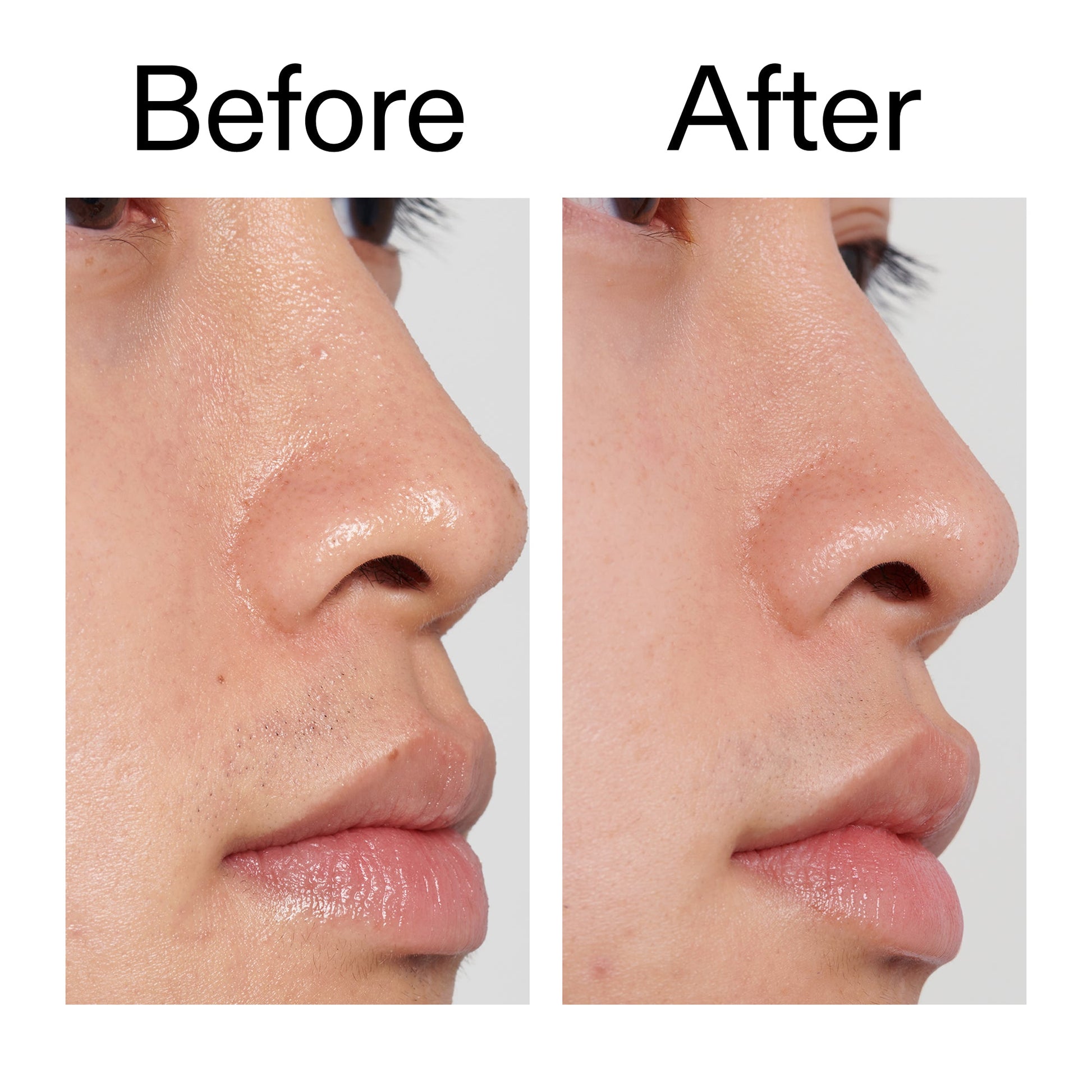 pha-toner-z7 PHA_Toner_Before_After_2000x2000_e3c10172-0150-4342-8b95-57417eaff50d.jpg