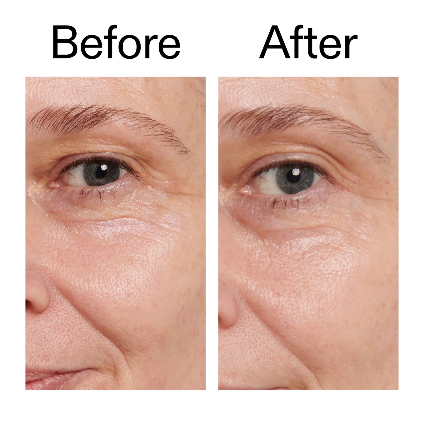 retinol-eye-cream-j0 Retinol_Eye_Cream_Before_After_2000x2000_ac03a80c-109e-4572-a95a-91dc109b4d27.jpg