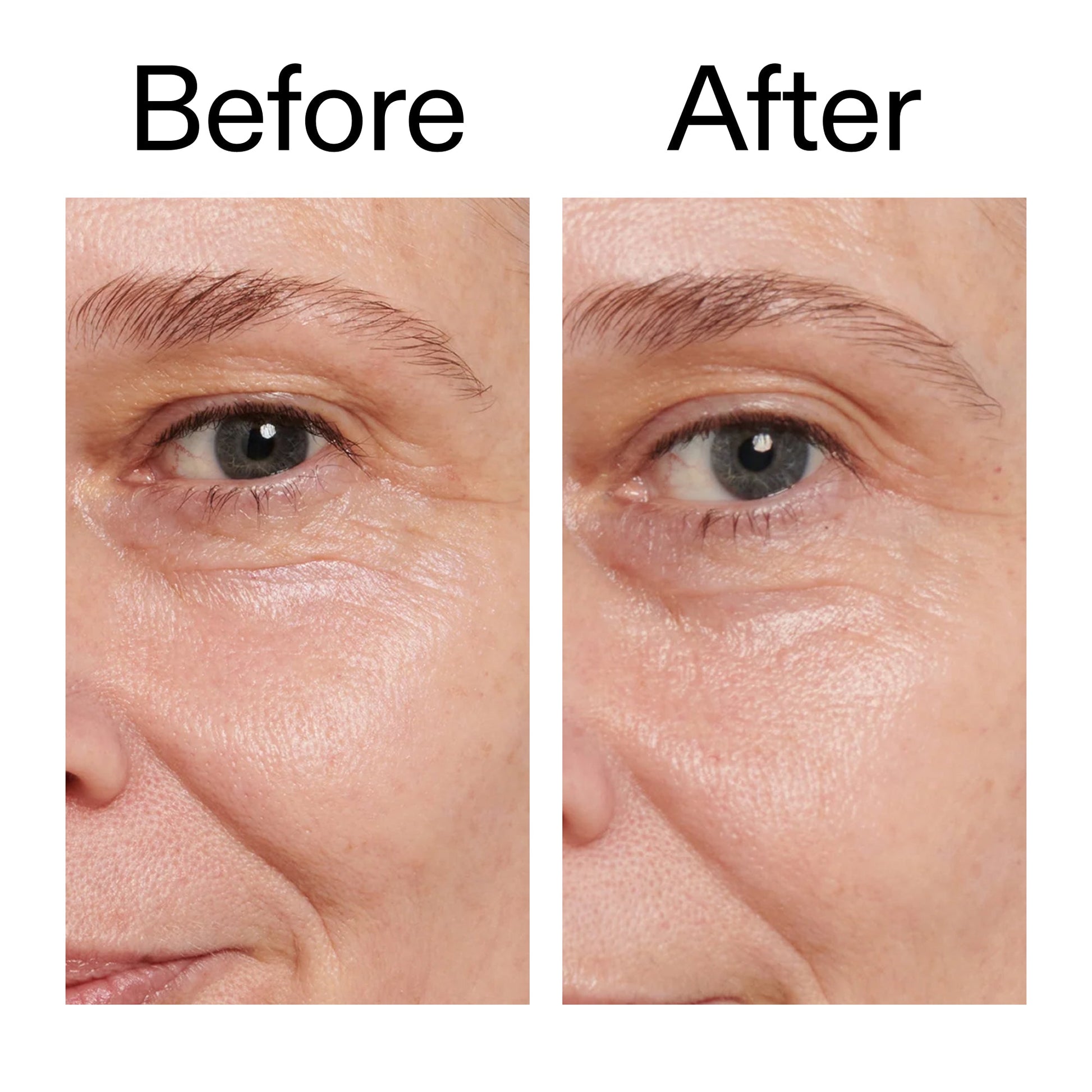 retinol-eye-cream-j0 Retinol_Eye_Cream_Before_After_2000x2000_ac03a80c-109e-4572-a95a-91dc109b4d27.jpg