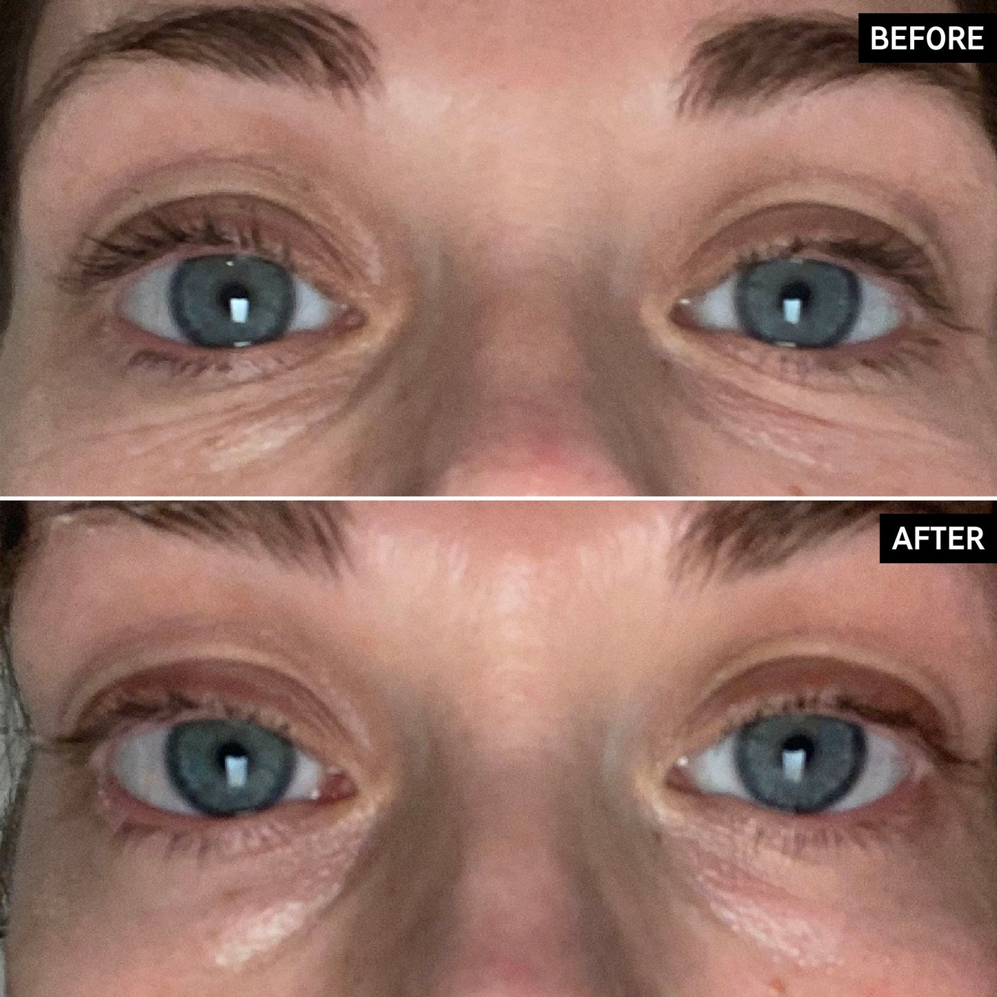 retinol-eye-cream-j0 SITE-UGCBAsApril_Nicole_B_A_PPage_2000x2000_1.jpg