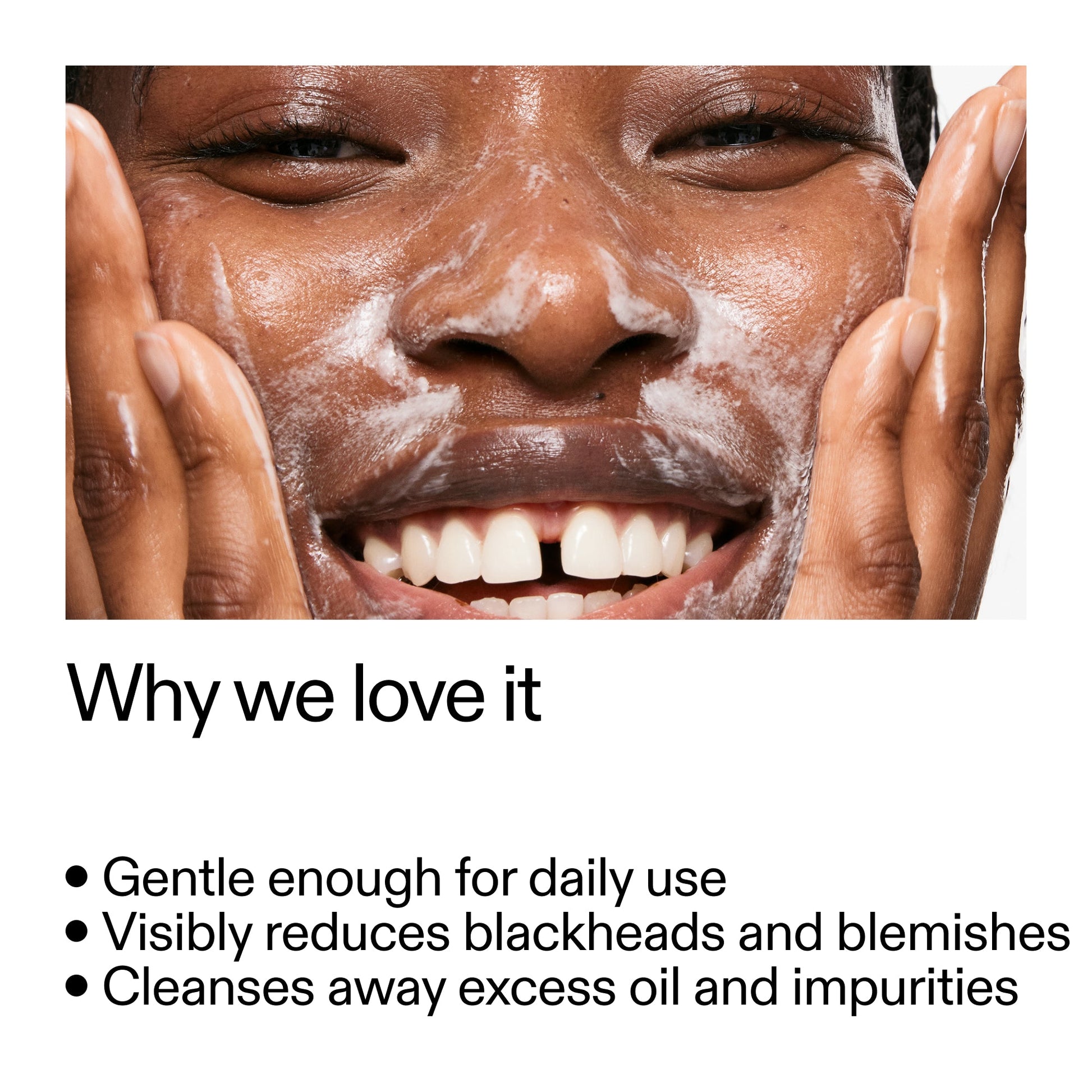 salicylic-acid-cleanser-duo-d9 Salicylic_Acid_Cleanser_-_300mlWhy_we_love_it_2000x2000_87dc92a9-2559-4309-98cd-4e570f1be735.jpg
