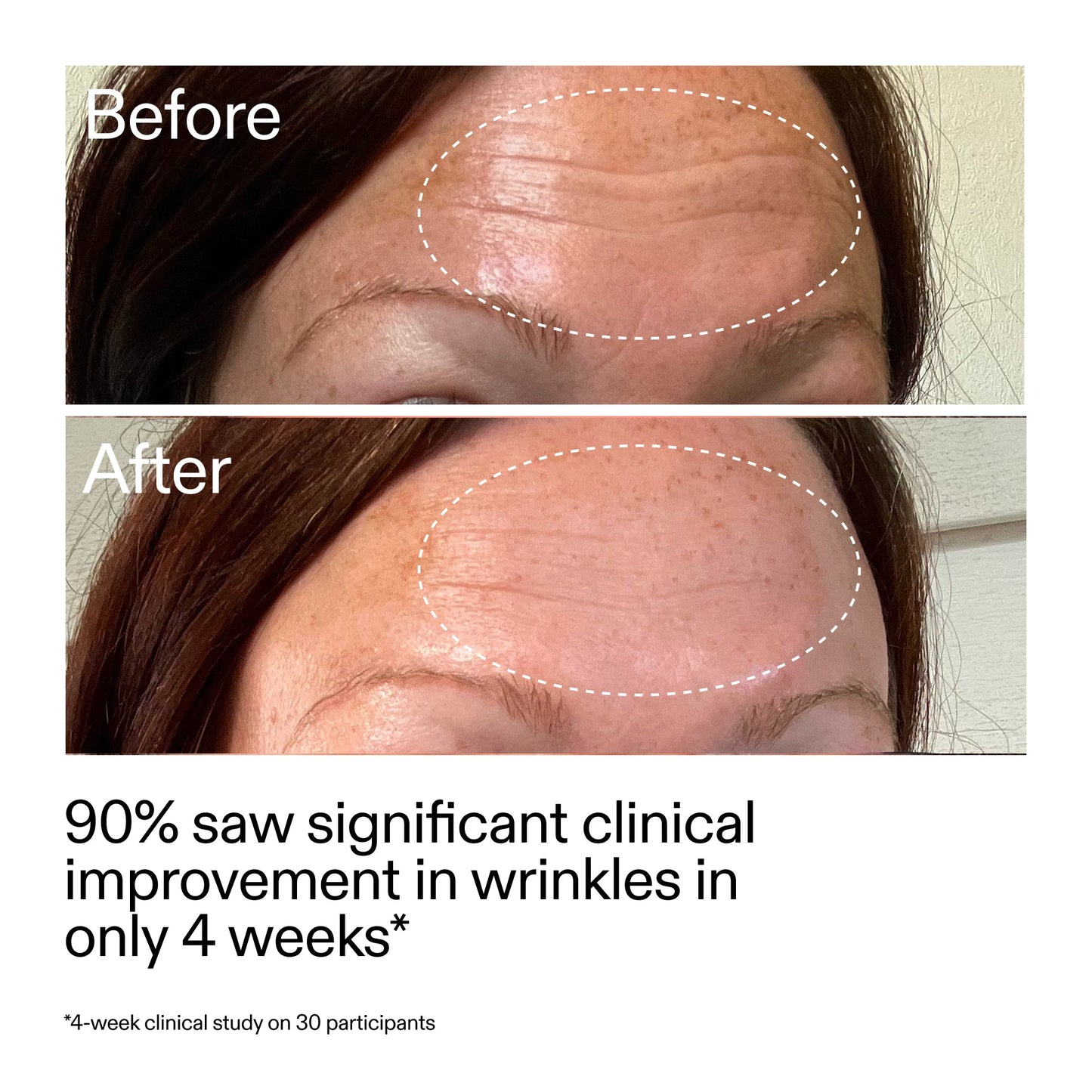 starter-retinol-serum-duo-e2 StarterRetinol_BeforeAfter_Claim1_2000x2000_03b4d6e5-a357-43b9-a855-aba5e35c57f3.jpg