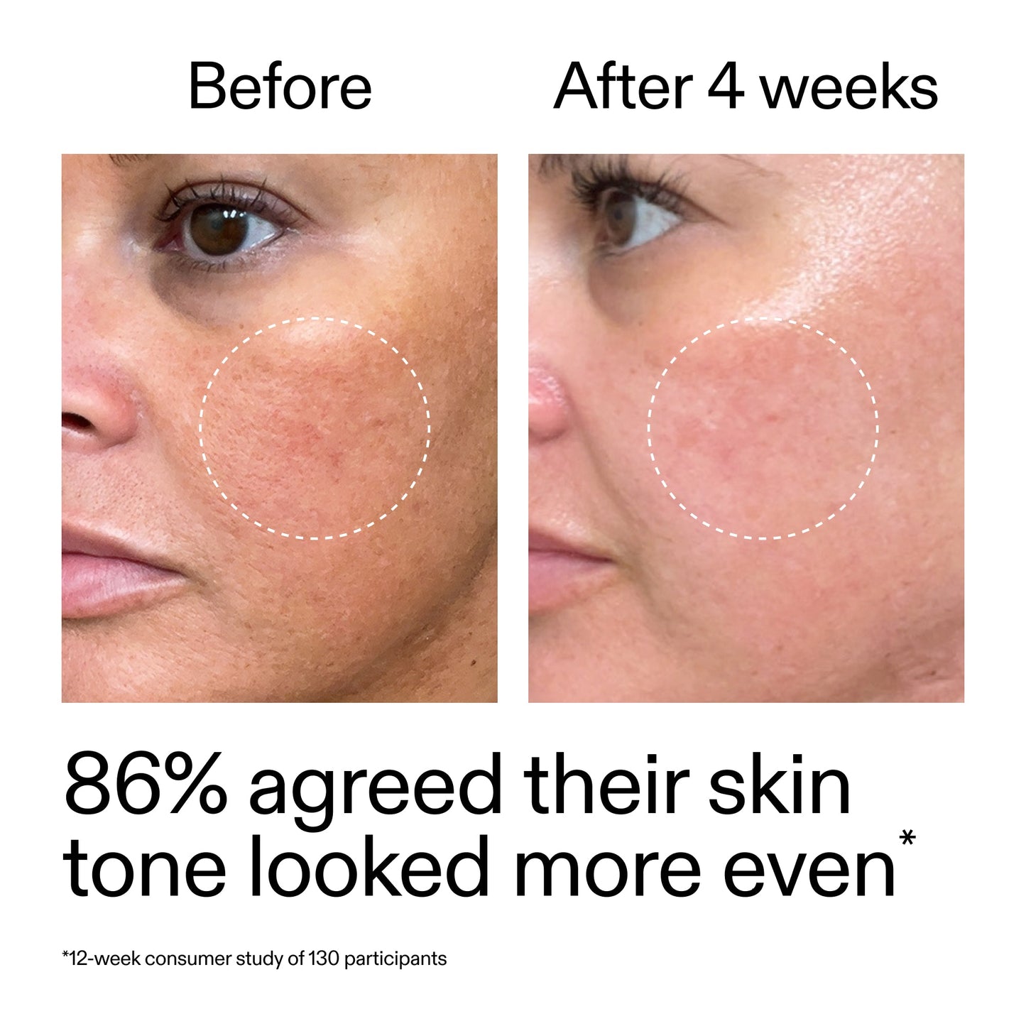 starter-retinol-serum-duo-e2 StarterRetinol_BeforeAfter_Claim2_2000x2000_fc5bb8ac-8588-478f-98d5-28af6651601a.jpg