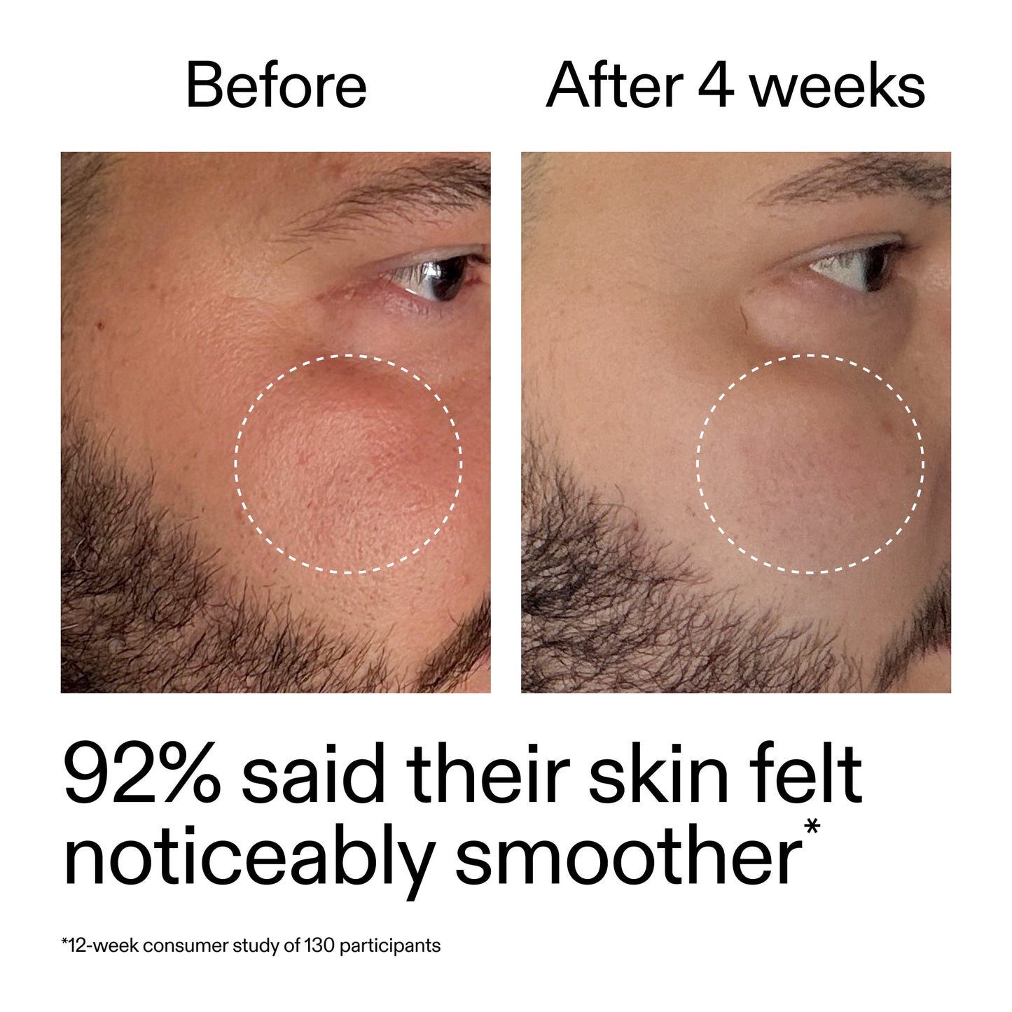 starter-retinol-serum-duo-e2 StarterRetinol_BeforeAfter_Claim3_2000x2000_458243a8-bbb0-4e5d-a274-29c7766d339b.jpg