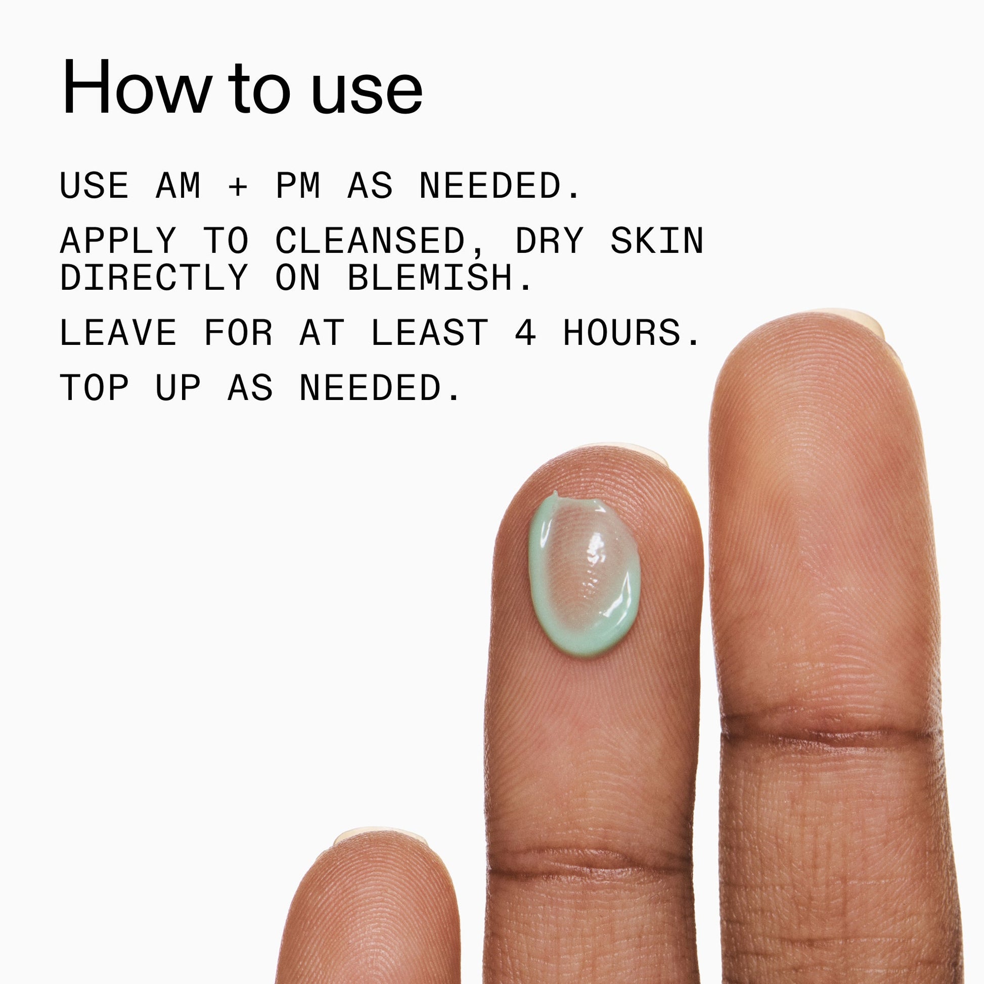 succinic-acid-acne-treatment-c4 Succinic_Acid_Treatment_How_to_Use_2000x2000_d57137d5-d7f1-427c-9a46-5fc00c19c542.jpg