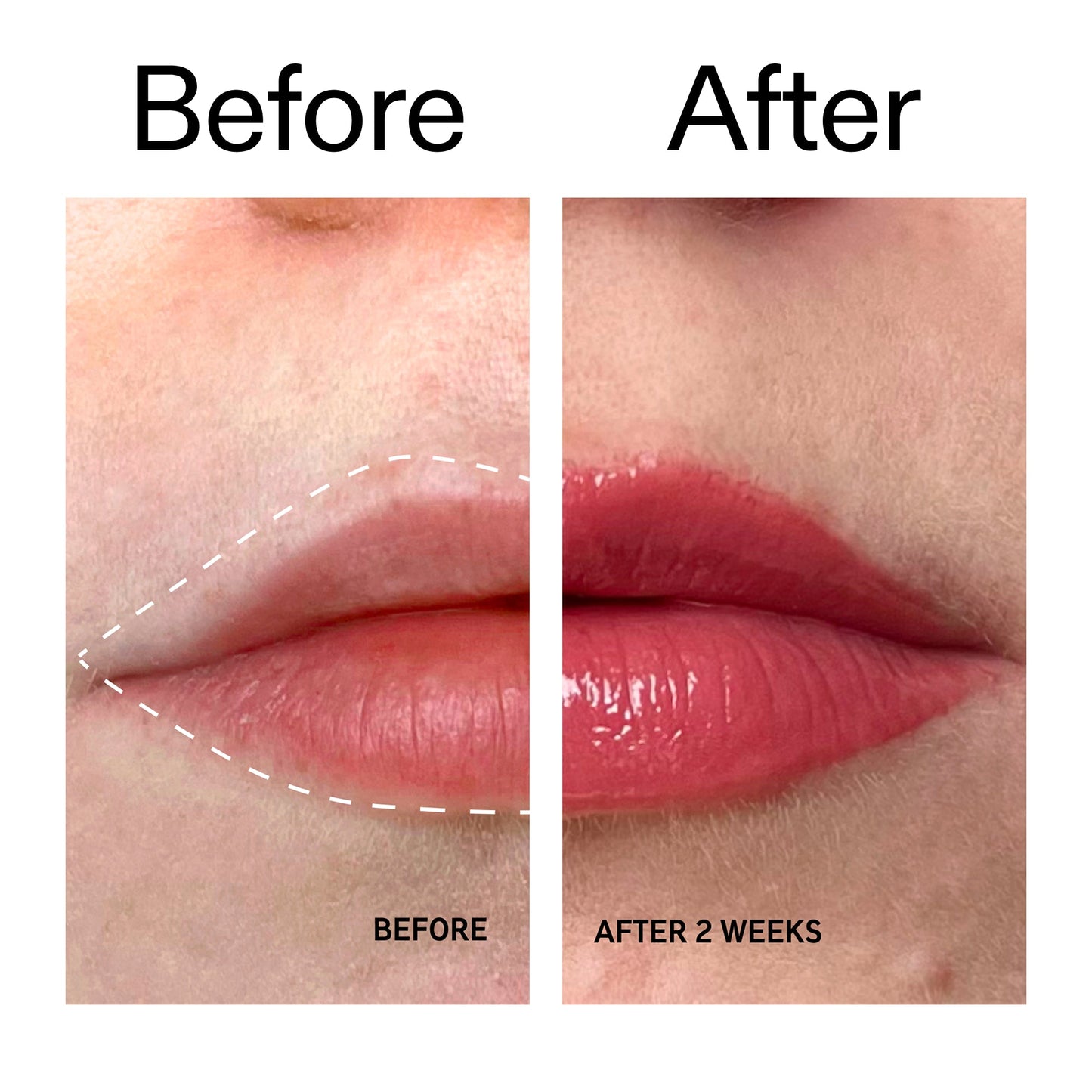 tripeptide-plumping-berry-lip-balm-c6 Tripeptide_Plumping_Lip_Balm_-_Berry_Before_After_2000x2000_9474bbd8-43ca-4b0e-b0e7-dfab70b91927.jpg