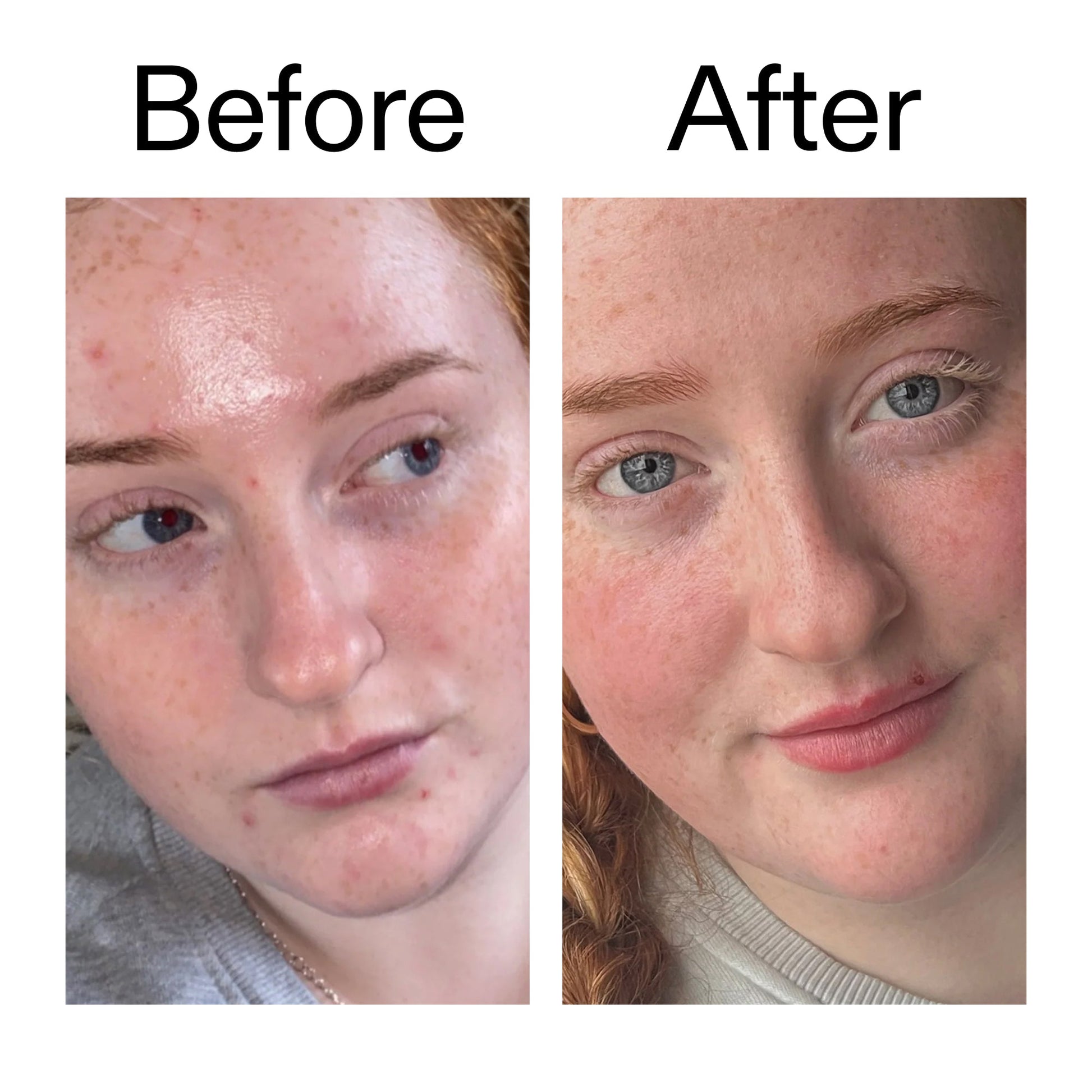 vitamin-b-c-and-e-moisturizer-r5 Vitamin_B_C_and_E_Moisturizer_Before_After_2000x2000_b0781a76-5ad2-4be9-95b8-ef92b356833c.jpg